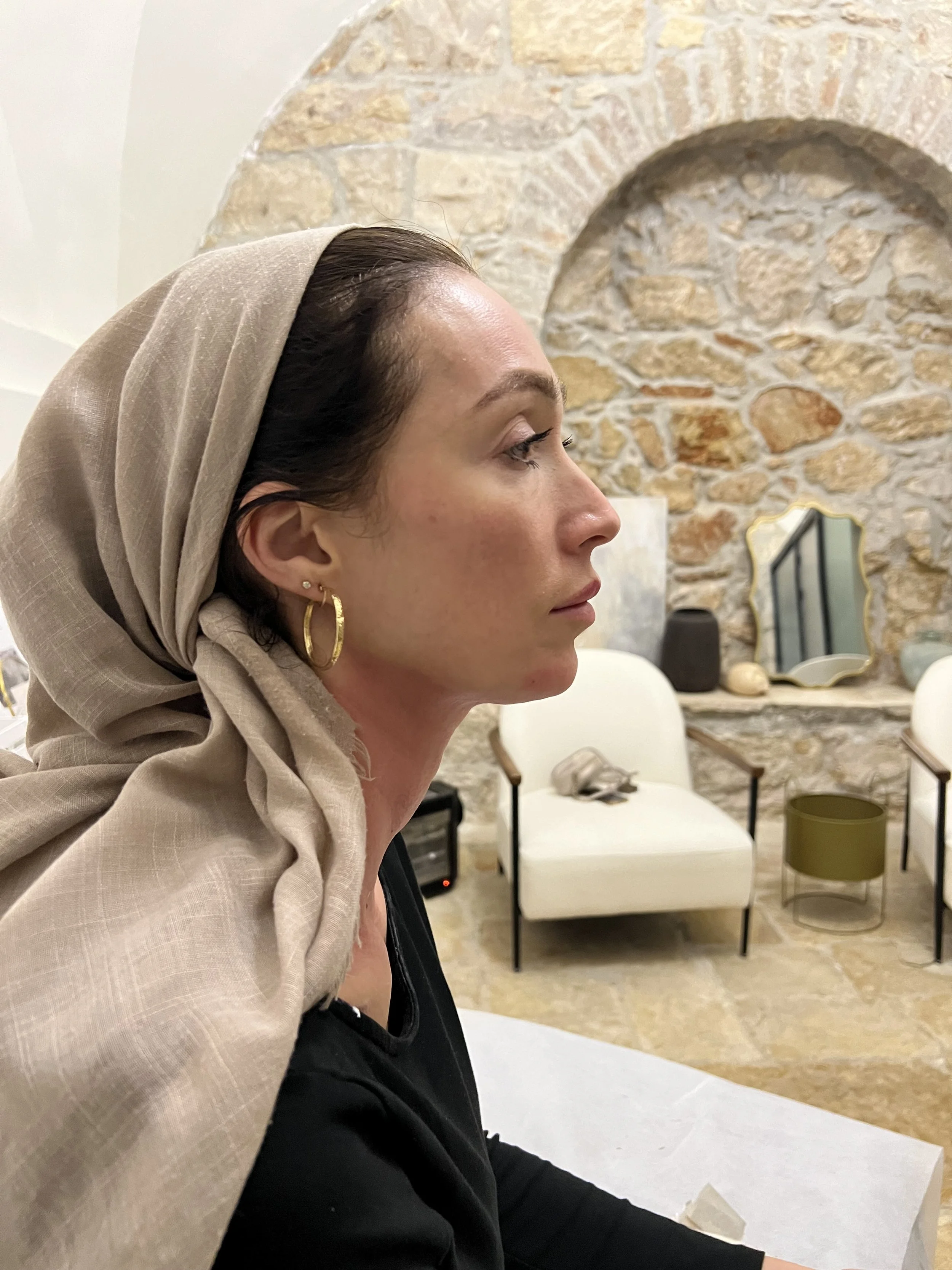 תוצאות לפני ואחרי הזרקת סקולפטרה למיצוק עור הפנים - רפואה אסתטית בירושלים