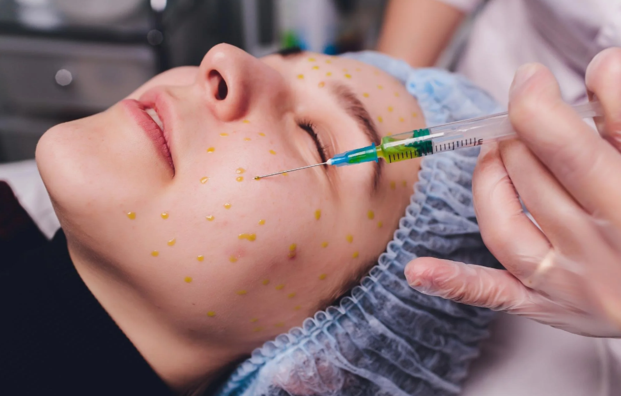 Aesthetic Fillers in Westhampton