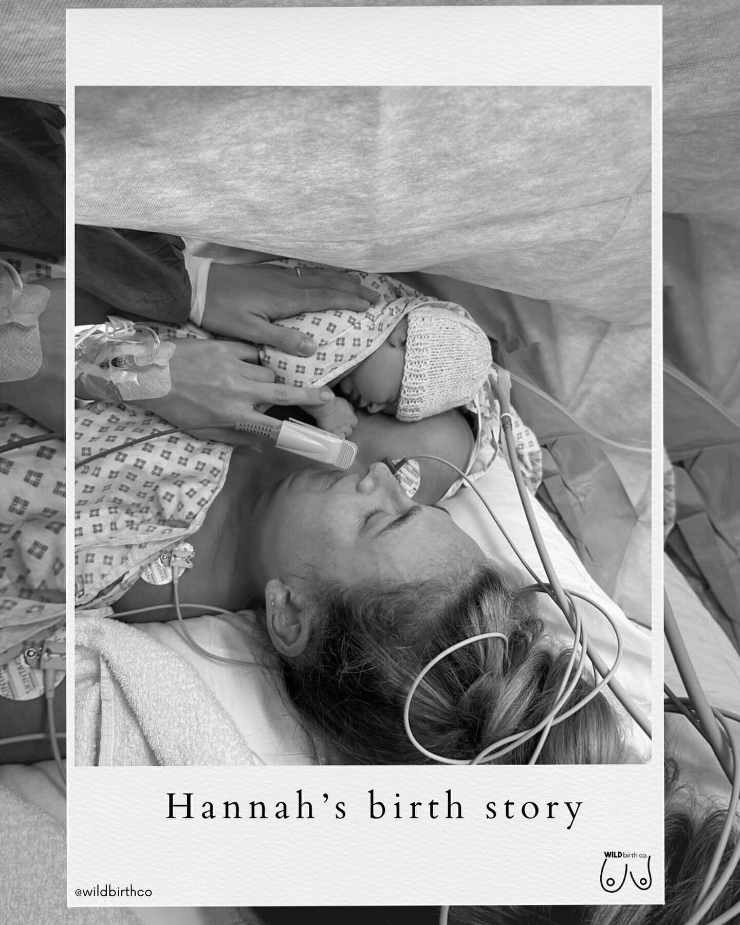 Thank you @hans_duggsxox for sharing your birth story with us 🌸
Hannah had meconium in her waters which put her in the high risk category but this is a beautiful story of how Hannah used Hypnobirthing techniques to give herself the opportunity to ha