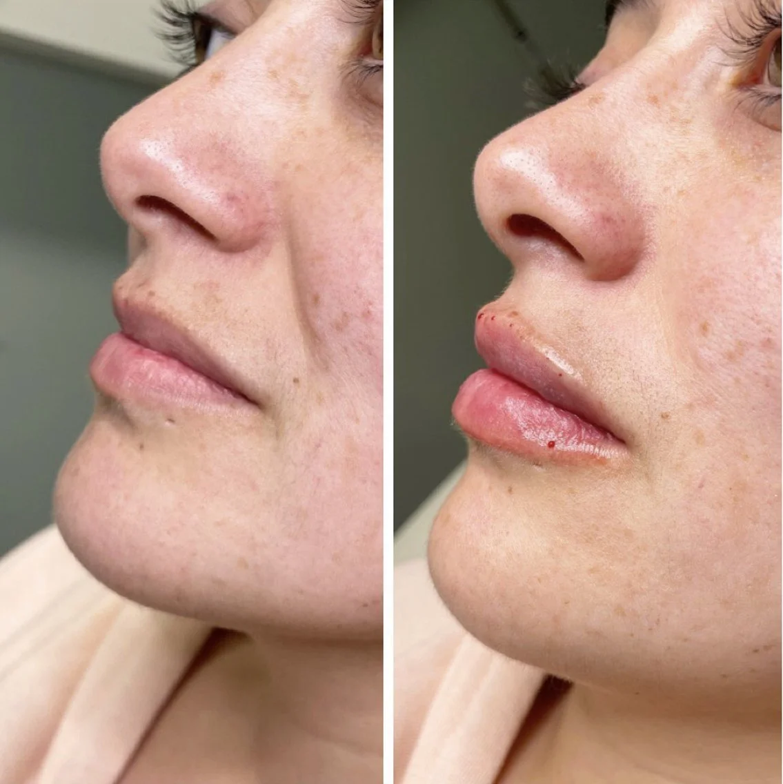 lips3 - Nicole Renteria.jpeg