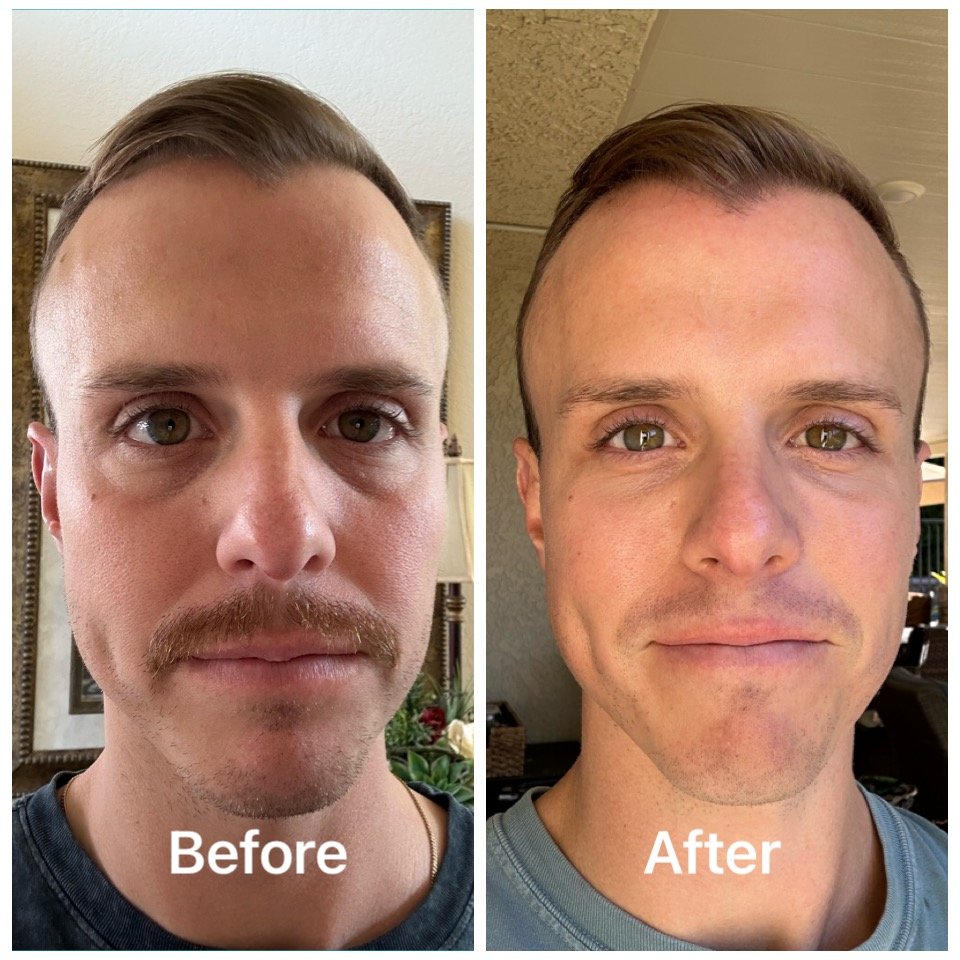 undereye - Nicole Renteria.JPG