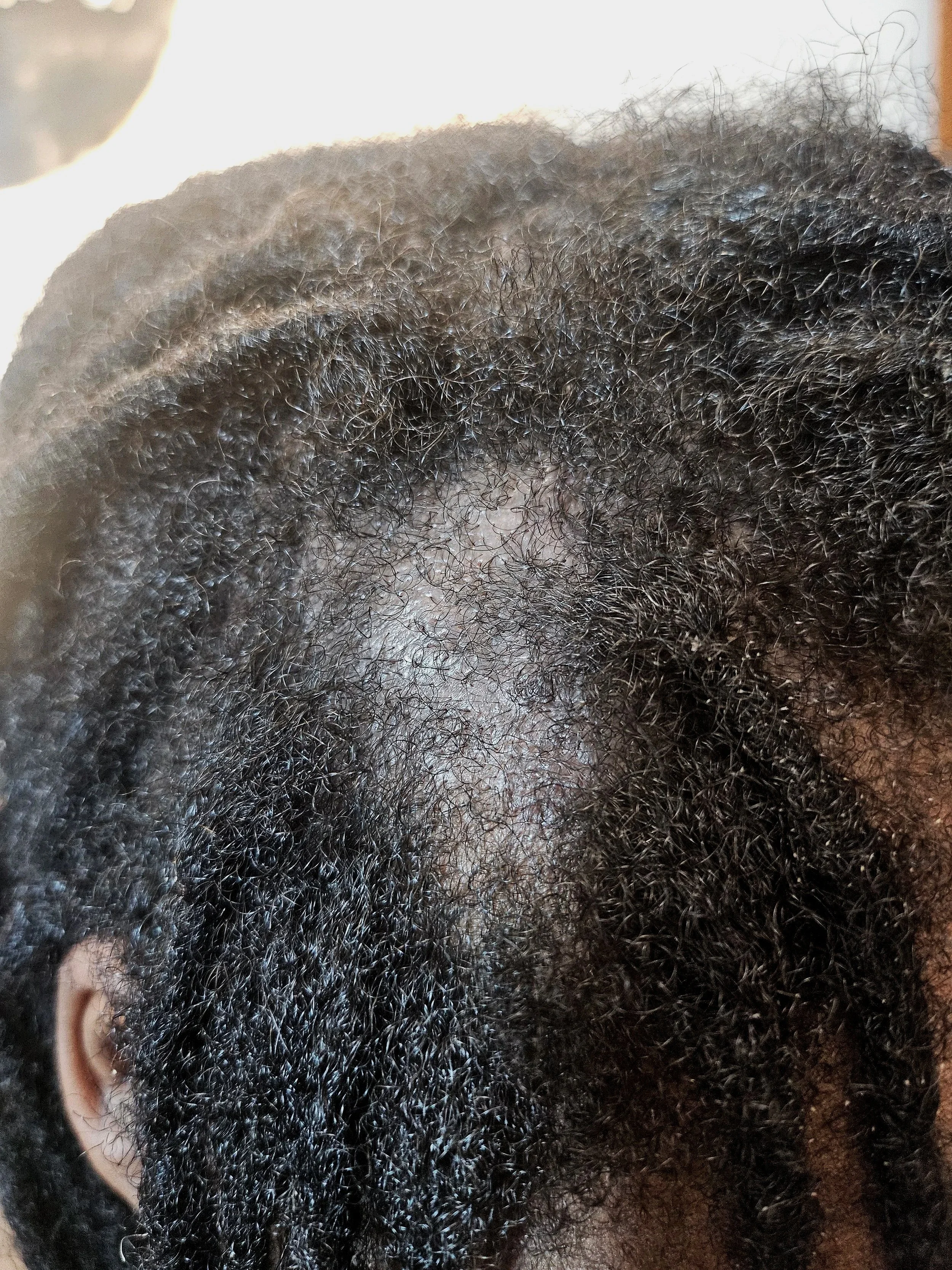 5 Common Loc Problems We See at TressesbyK and How We Help Our Clients..