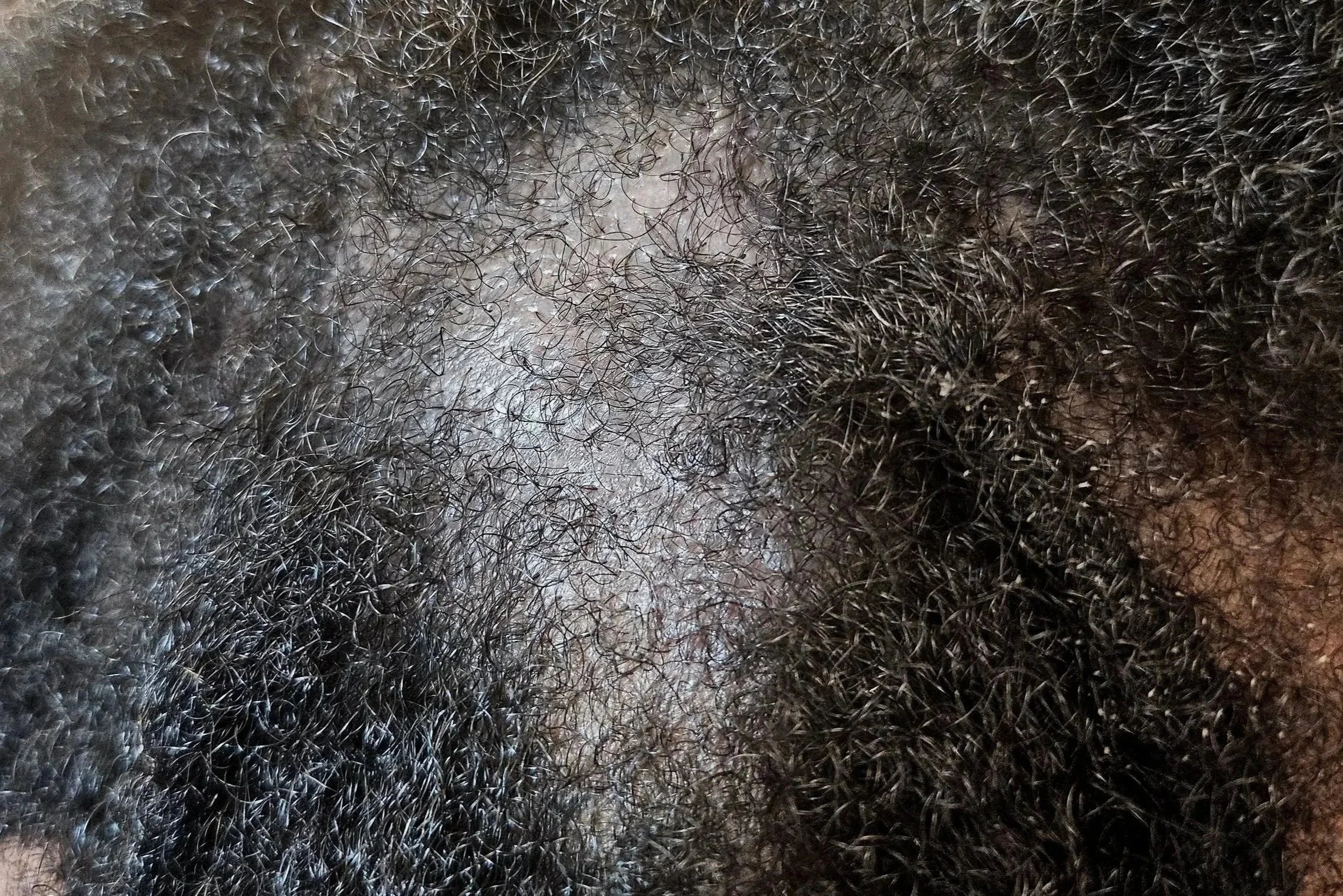 5 Common Loc Problems We See at TressesbyK and How We Help Our Clients..