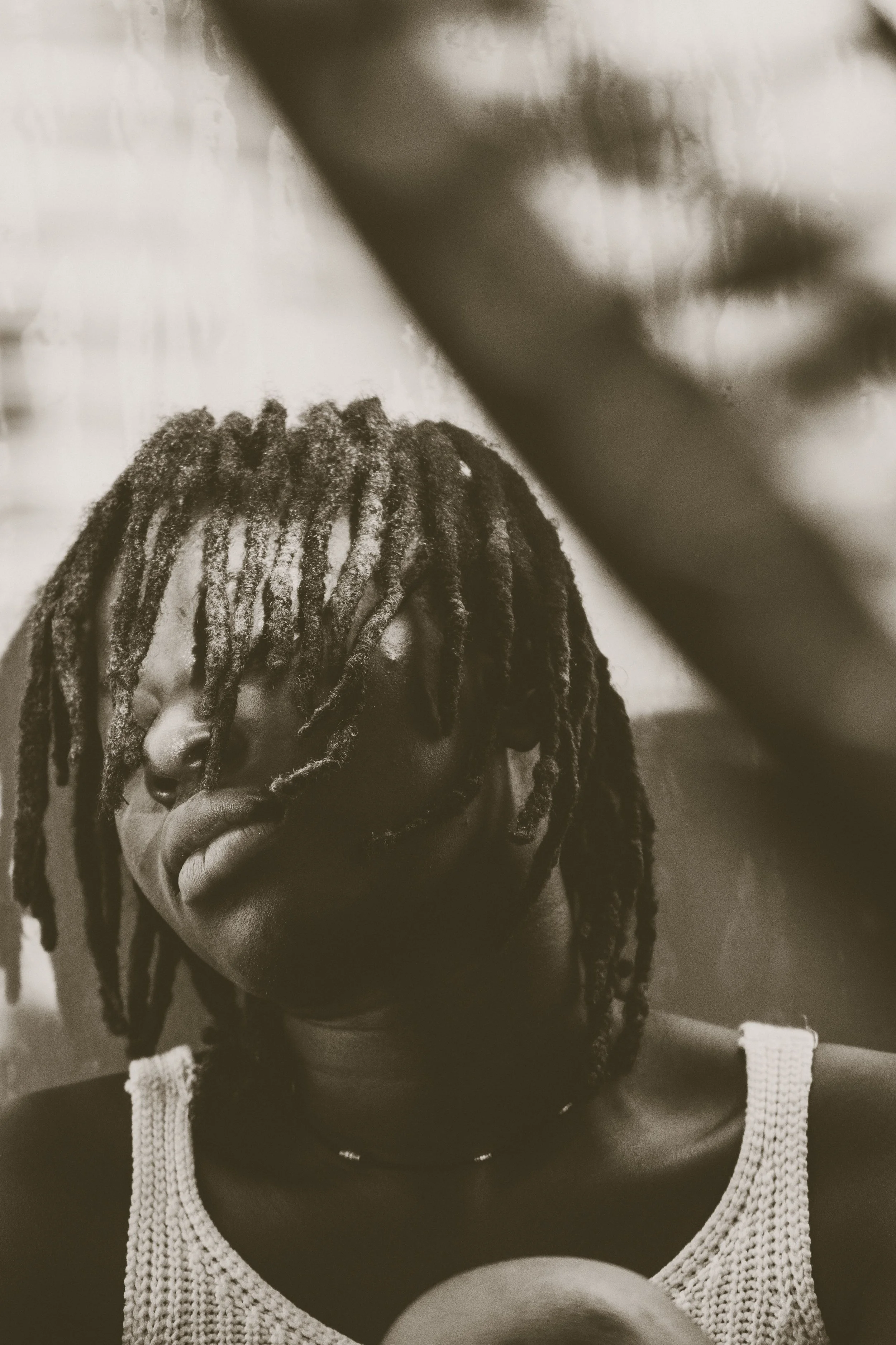Itchy Scalp With Locs: What to Try at Home and When to Get Help