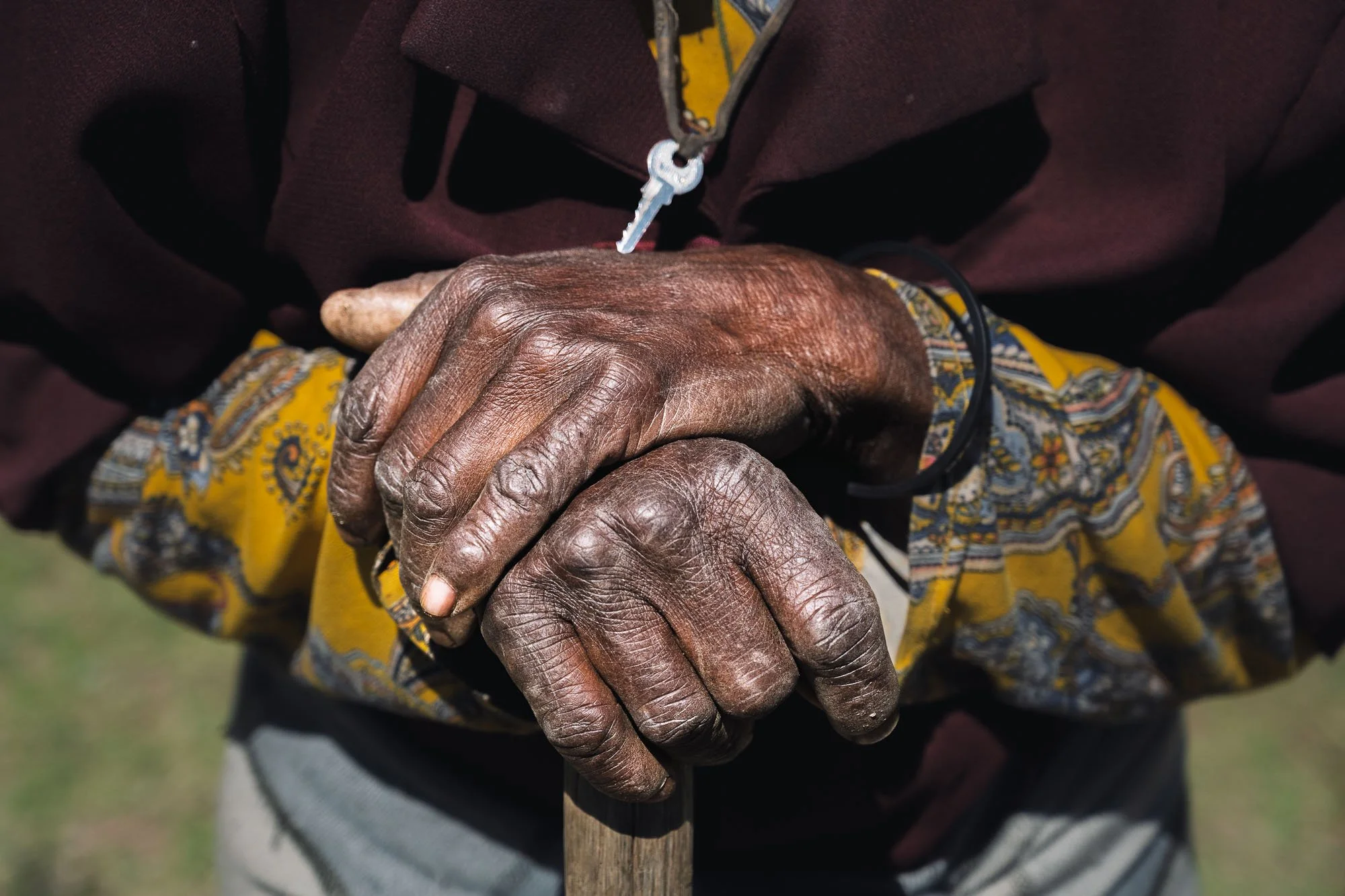 Extreme close-up detail of elderly, heavily calloused and swollen hands resting on the handle of a wooden walking stick, with a safety-pinned key on the chest
