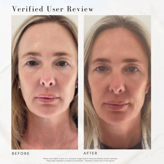 before and after watercolor.webp