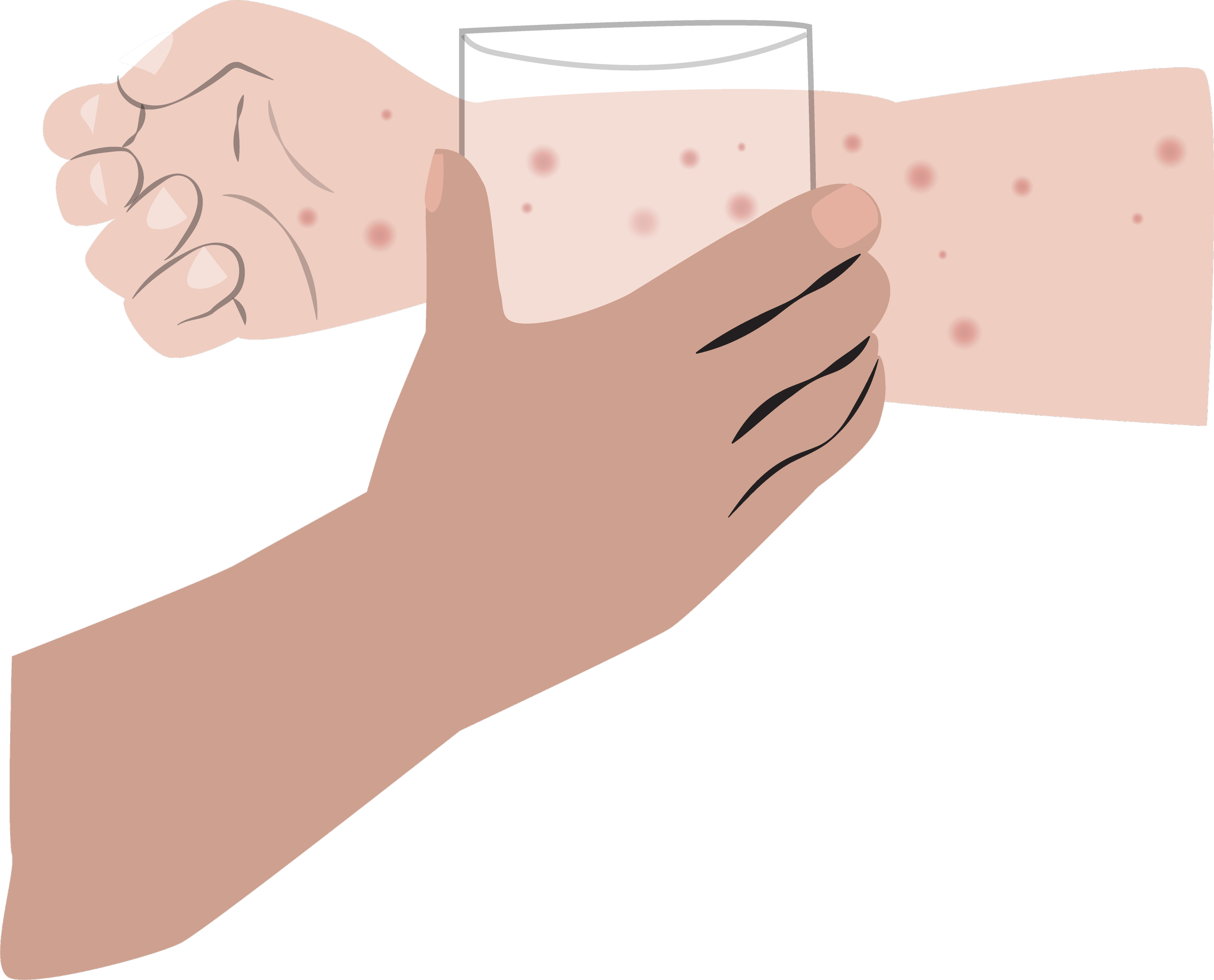 Rash that does not fade.png