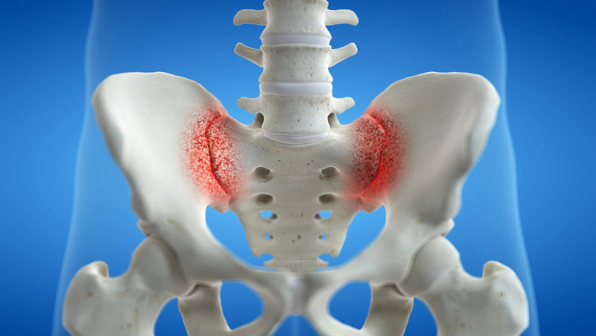 Sacroiliac Joint Dysfunction JACQUELINE WEISBEIN DO PAIN 