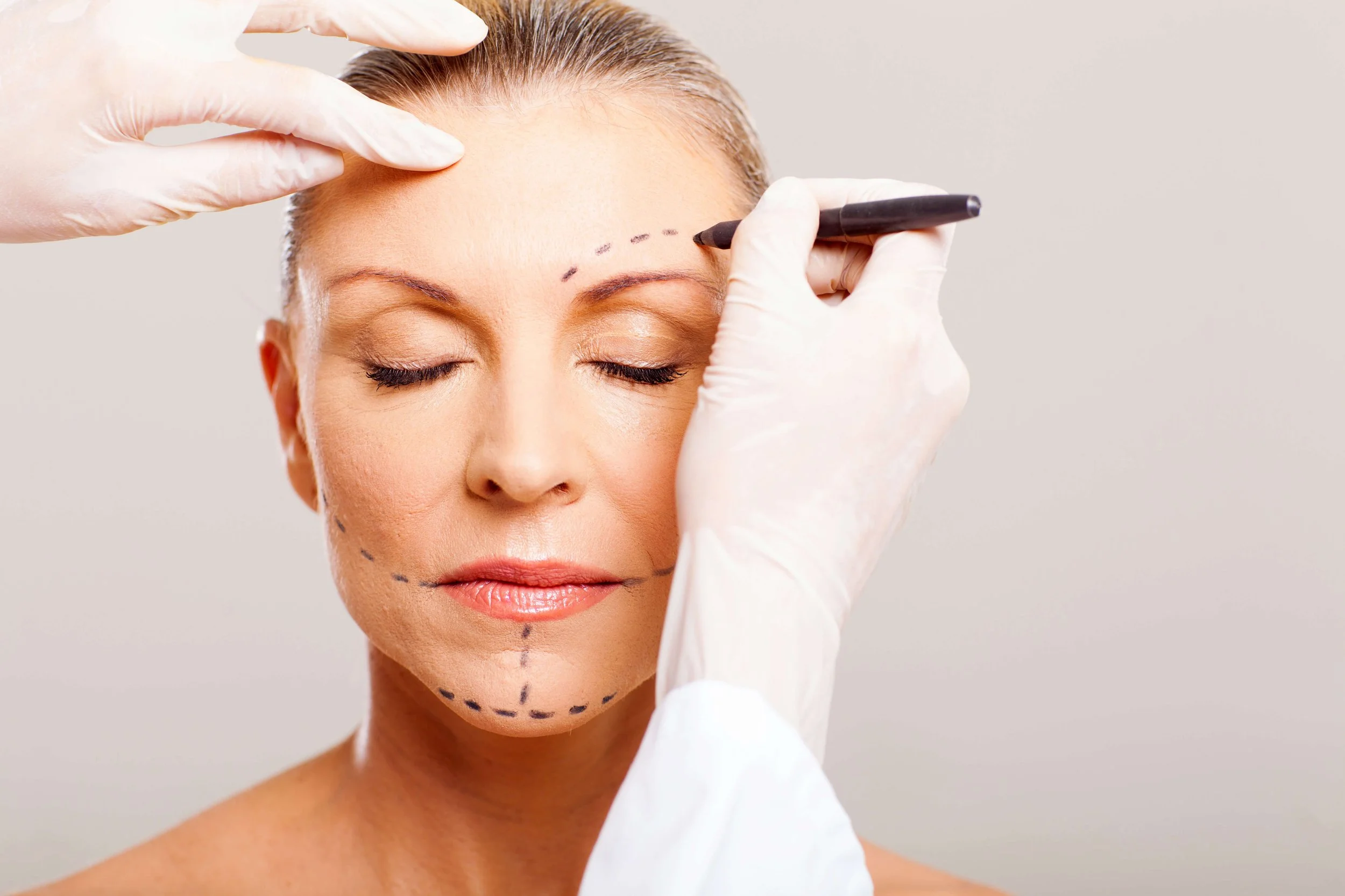 choosing the right facelift for you. consultation photo