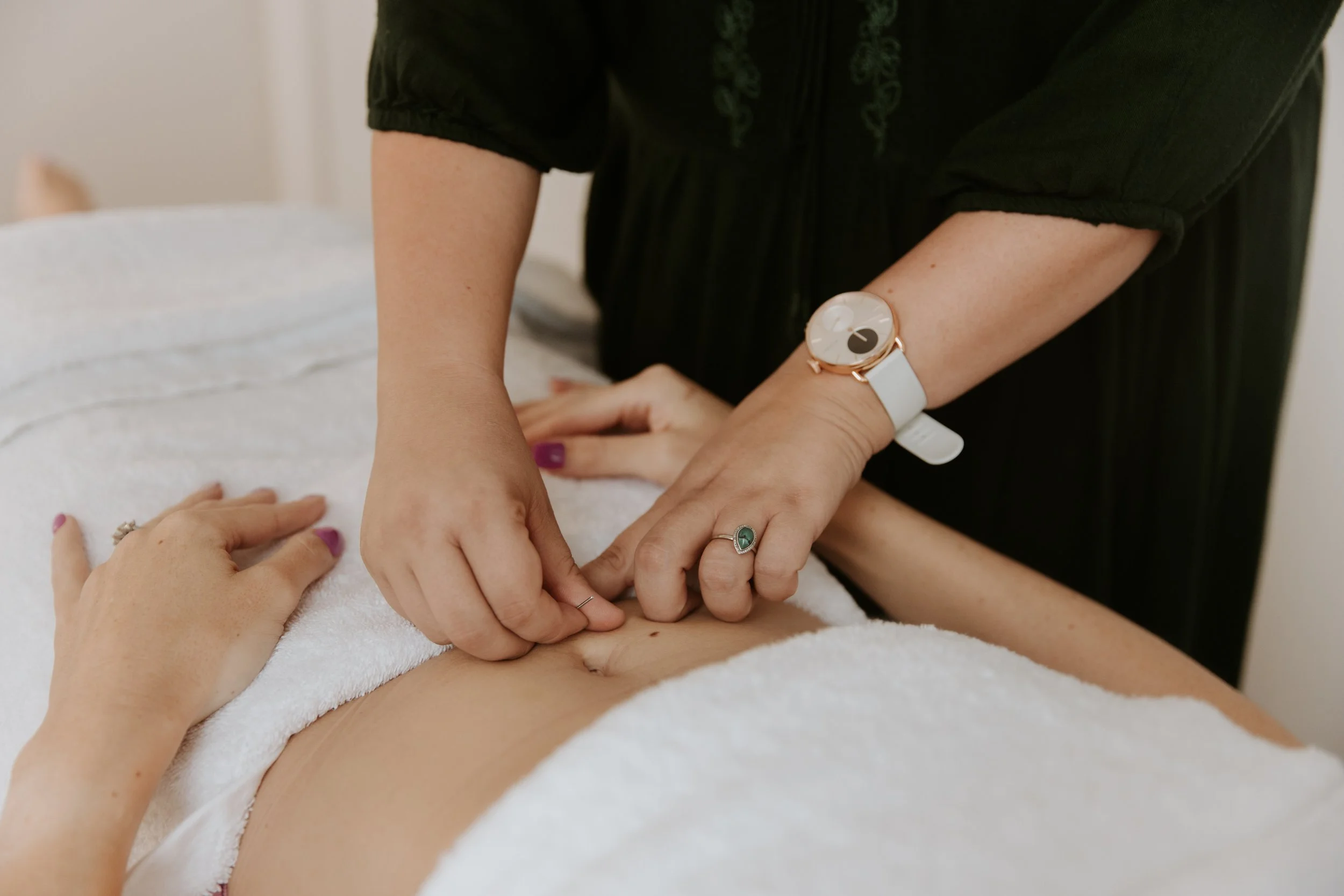 Person performing acupuncture on a woman's abdomen