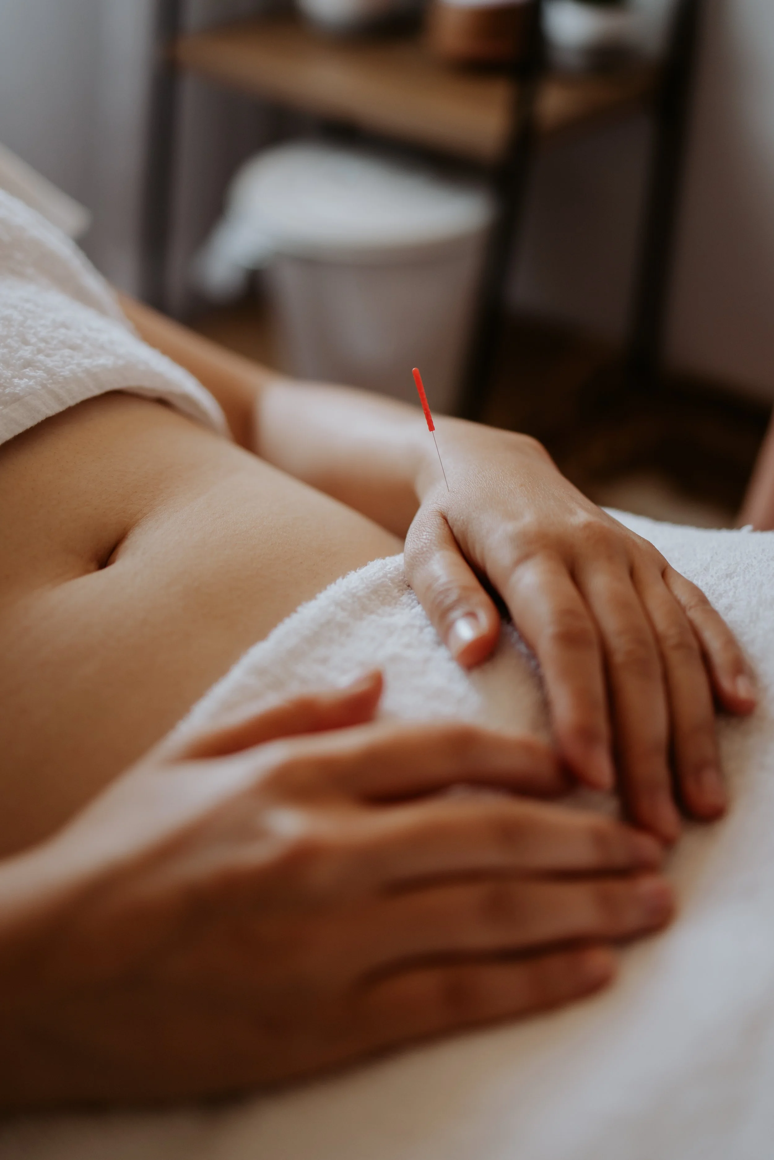 An acupuncture needle in an acupuncture point on the hand