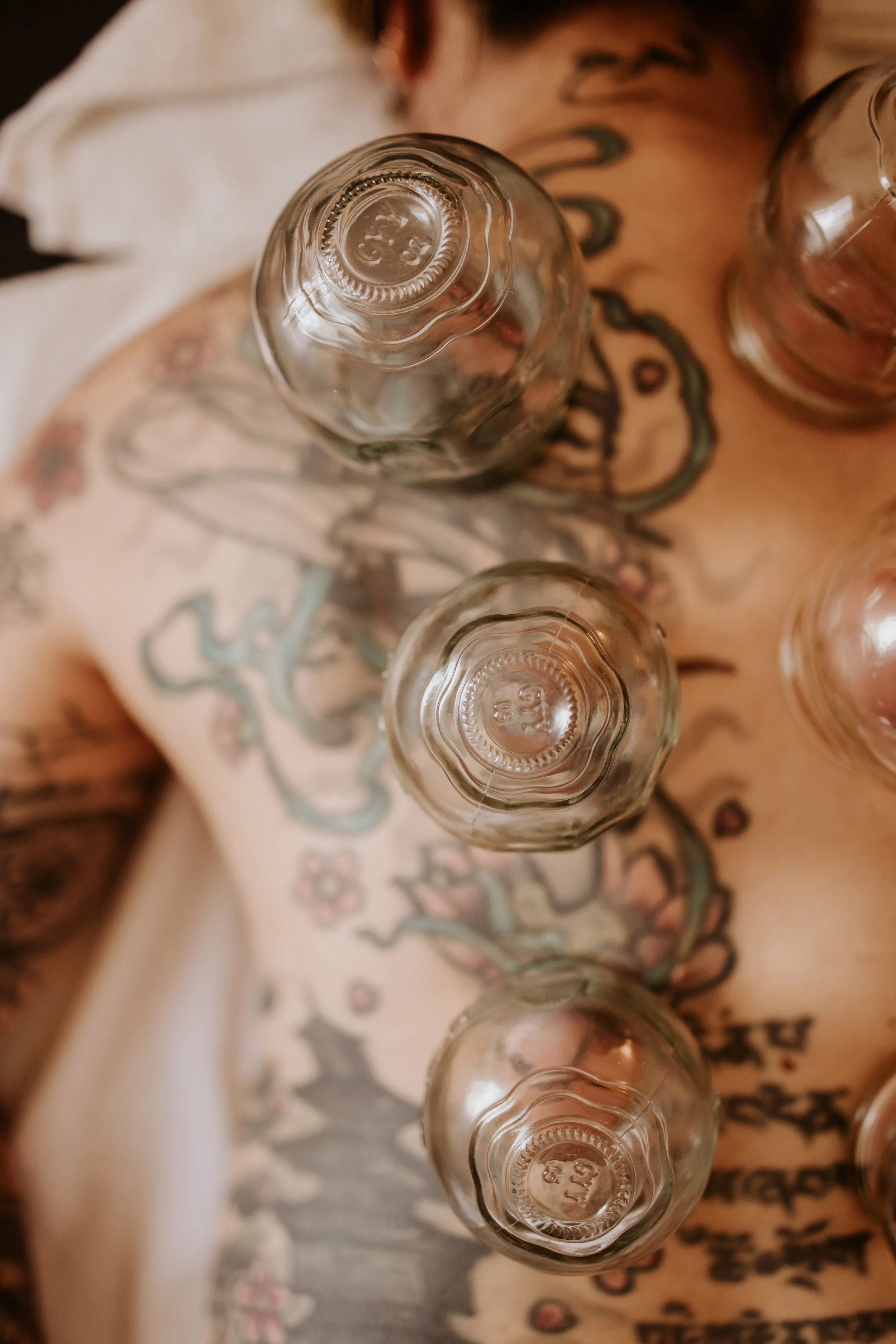 Cupping and Acupuncture for women's health, hormone balance, fertility, pregnancy, postpartum support, mental health, digestion and more in Mudgeeraba, Gold Coast.