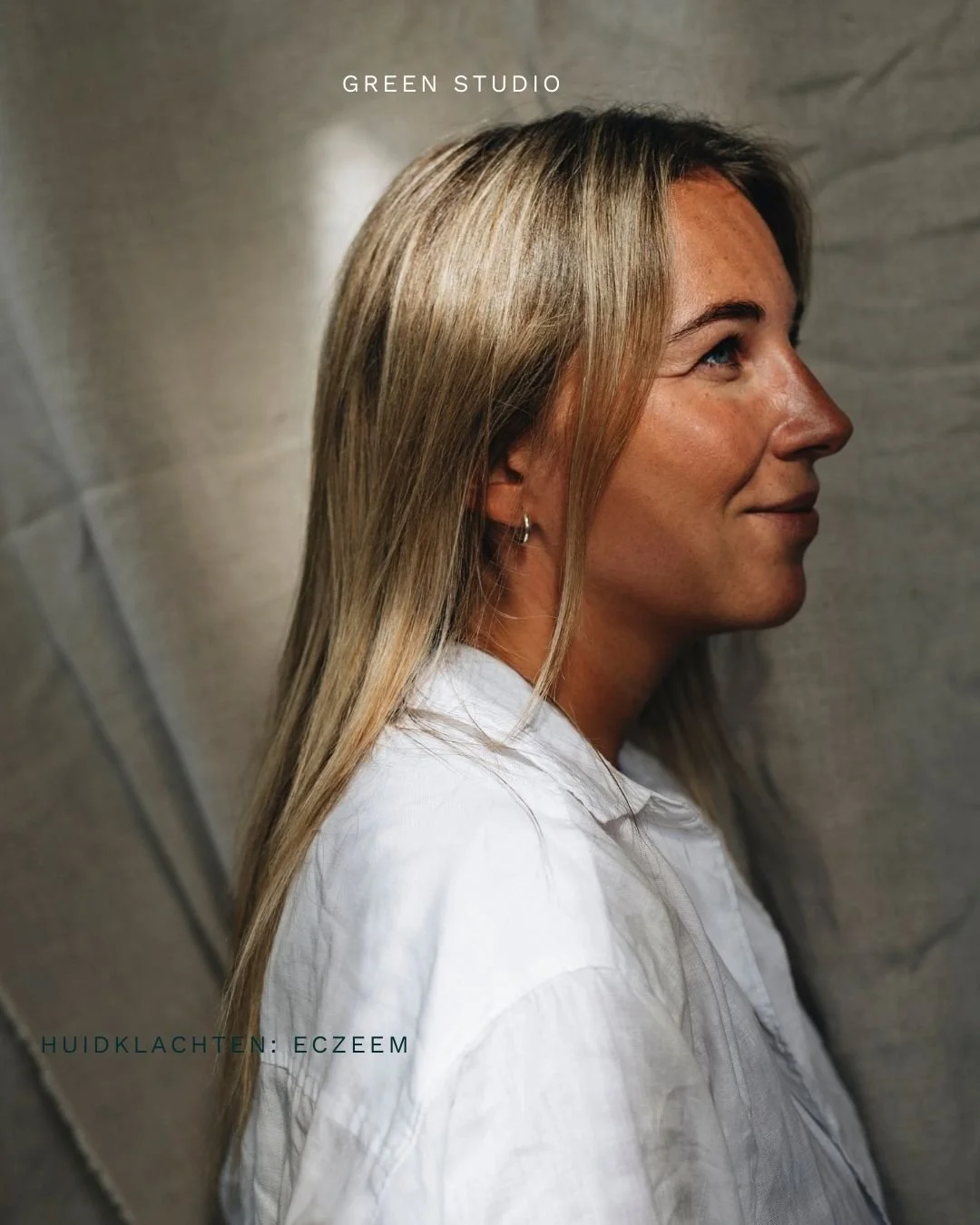 Huidklachten: eczeem