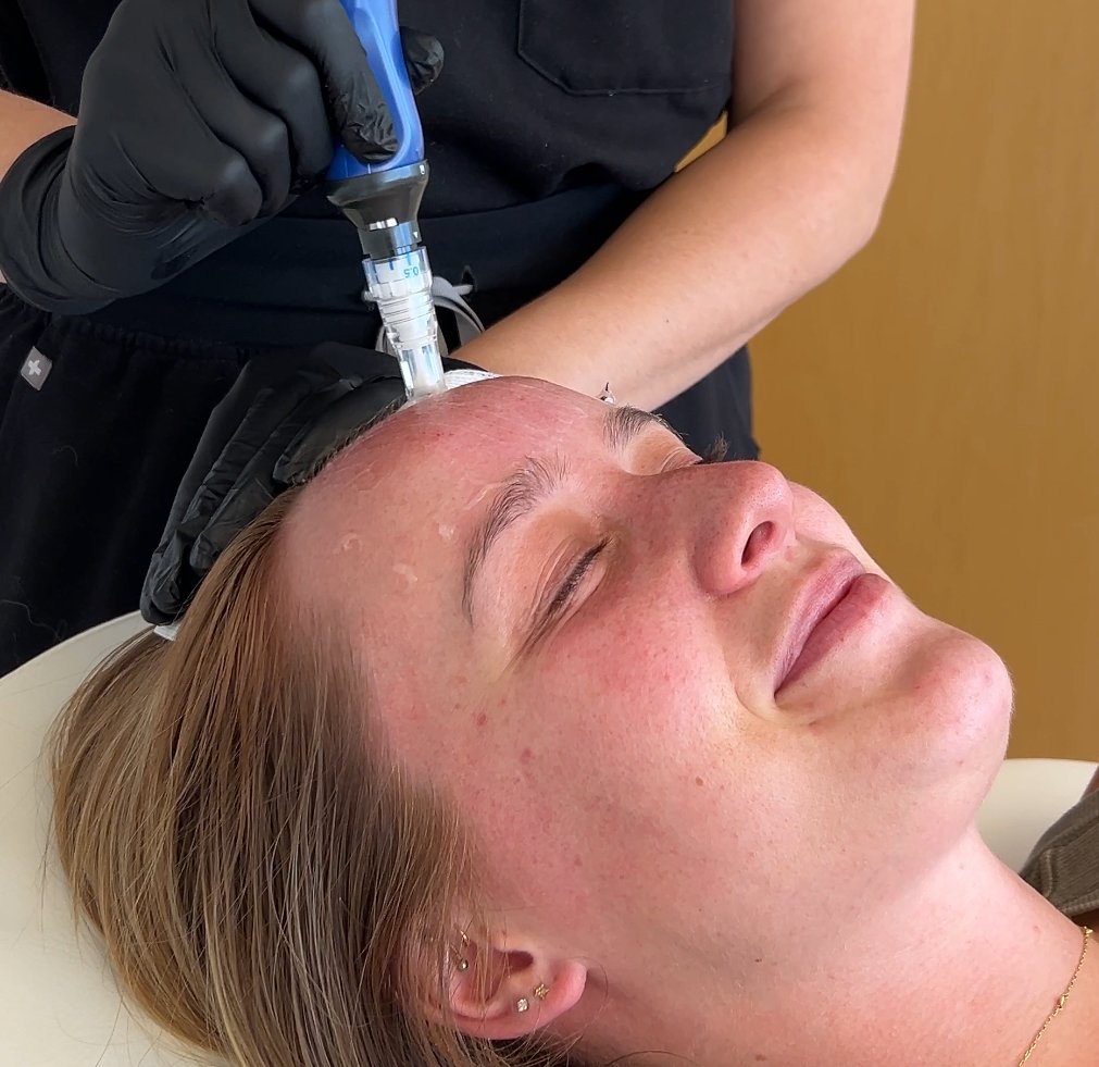 New client special botox, filler, microneedling, chemical peel discount | Poshpod Lakewood medspa