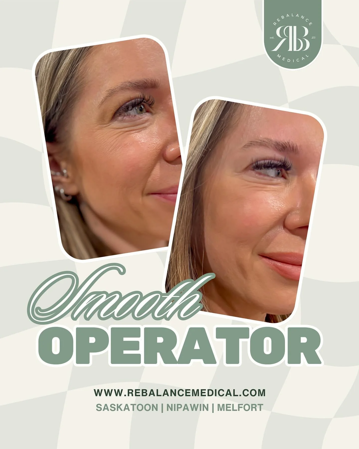 Not every line needs to disappear &mdash; we believe in softening, not freezing.
Our gentle Bo/Tox treatments target crow&rsquo;s feet while keeping your natural expressions intact, because some lines are part of your story &mdash; and that&rsquo;s o
