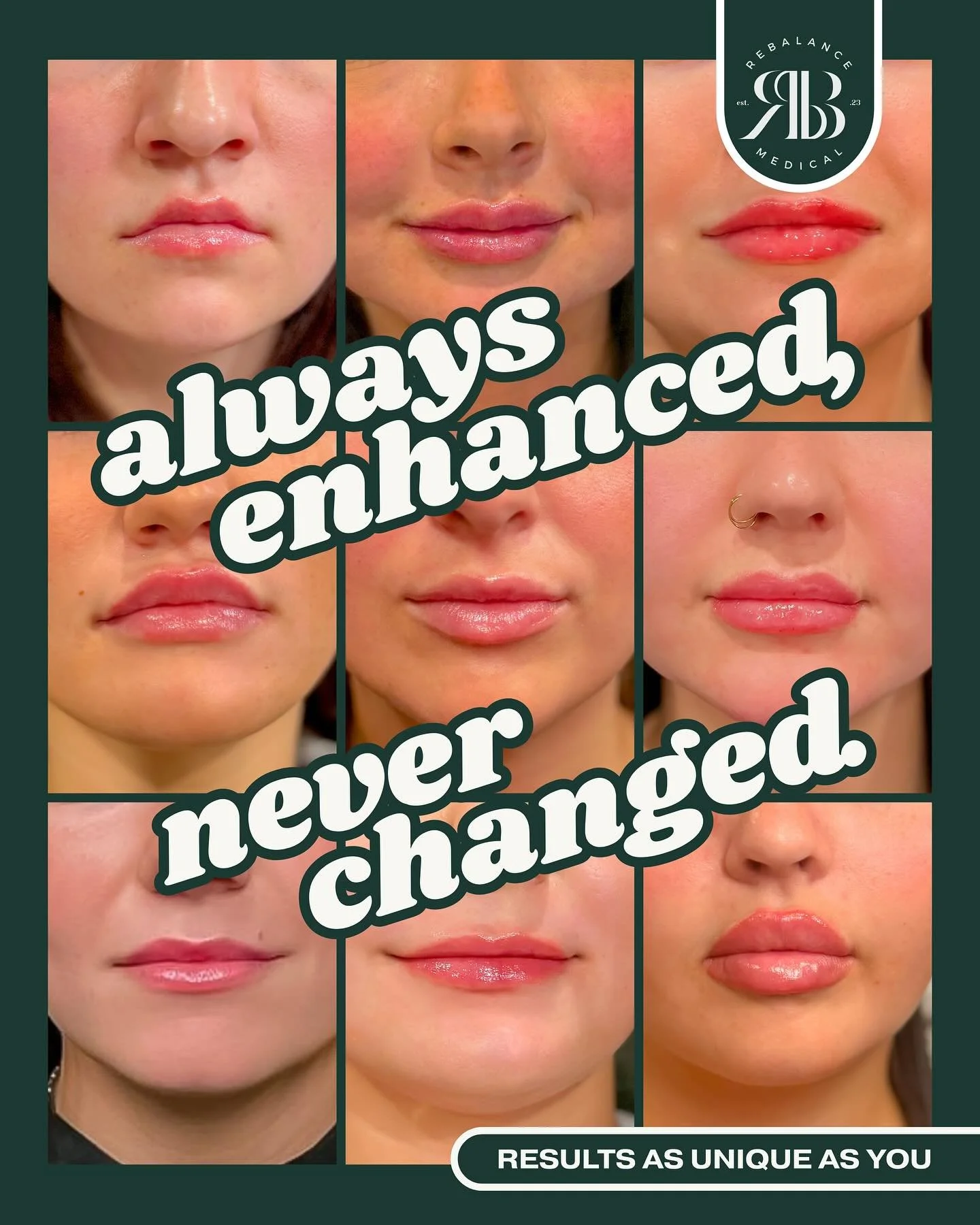 Enhancement should look like you&mdash;just a little more polished, hydrated, and confident. Subtle, natural lip filler tailored to your features. Book your lip consultation at ReBalance Medical.