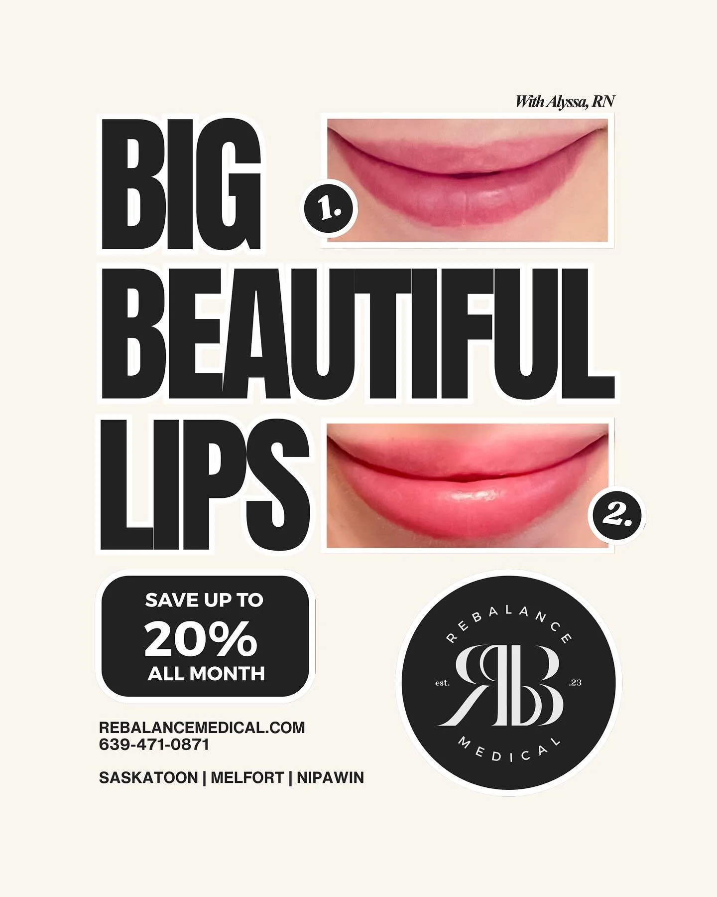 Big, beautiful lips&mdash;your way
February is the perfect time to enhance, define, or restore lip volume with perfectly placed, natural-looking filler&mdash;and save while you do it.
February Filler Special &bull; &frac12; syringe &mdash; $299 &bull