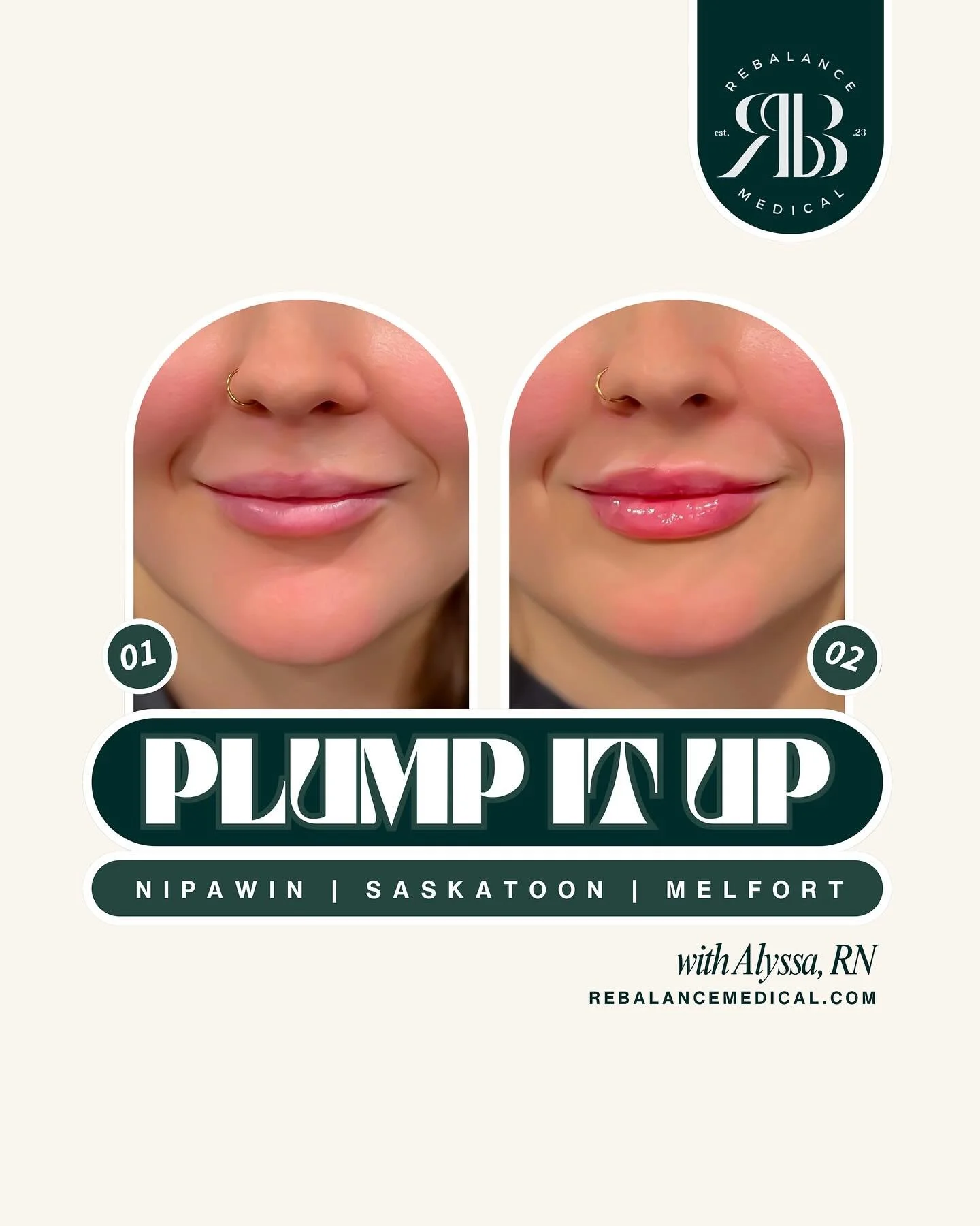 Summer is coming, are you ready?
Get that fresh, hydrated, sun-ready look with soft volume and natural definition tailored just for you.
Feel confident, feel fresh, feel summer-ready!
Book your appointment today.

#lips #lipfillers #lipfillerbeforean