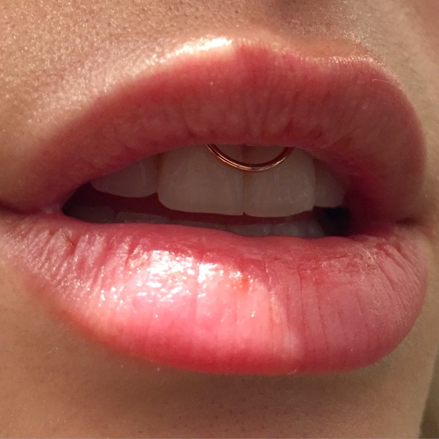 Smiley Piercing by J. Colby Smith