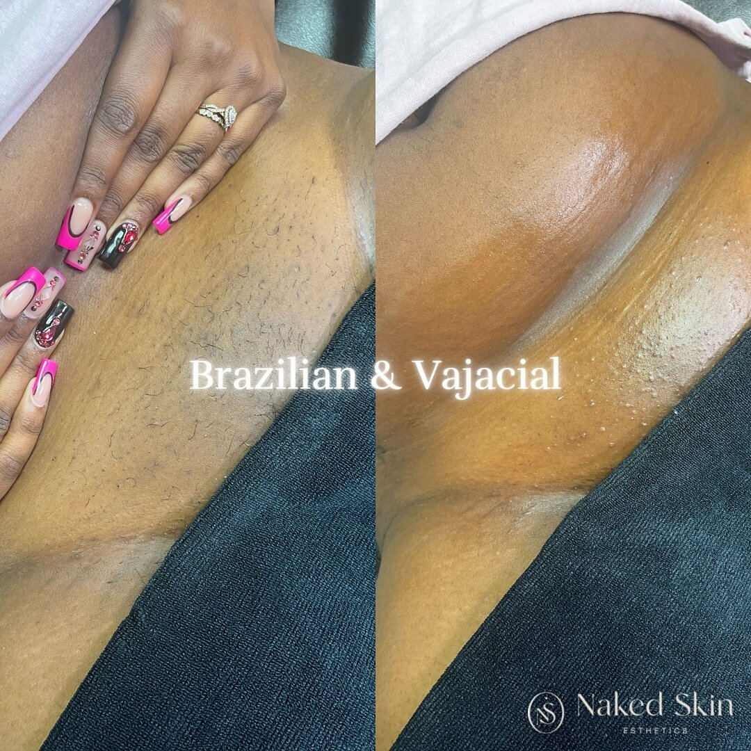 Step into relaxation and rejuvenation with a Brazilian wax followed by a vajacial, combining smoothness and skincare for a pampering experience that leaves you feeling refreshed, confident, and utterly radiant. ✨

#esthetician #wax #beforeandafter #t