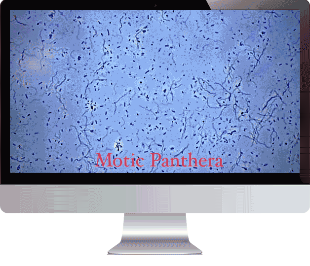 Computer monitor displaying a microscopic view of bacteria with the label 'Motic Pantera' in red text.