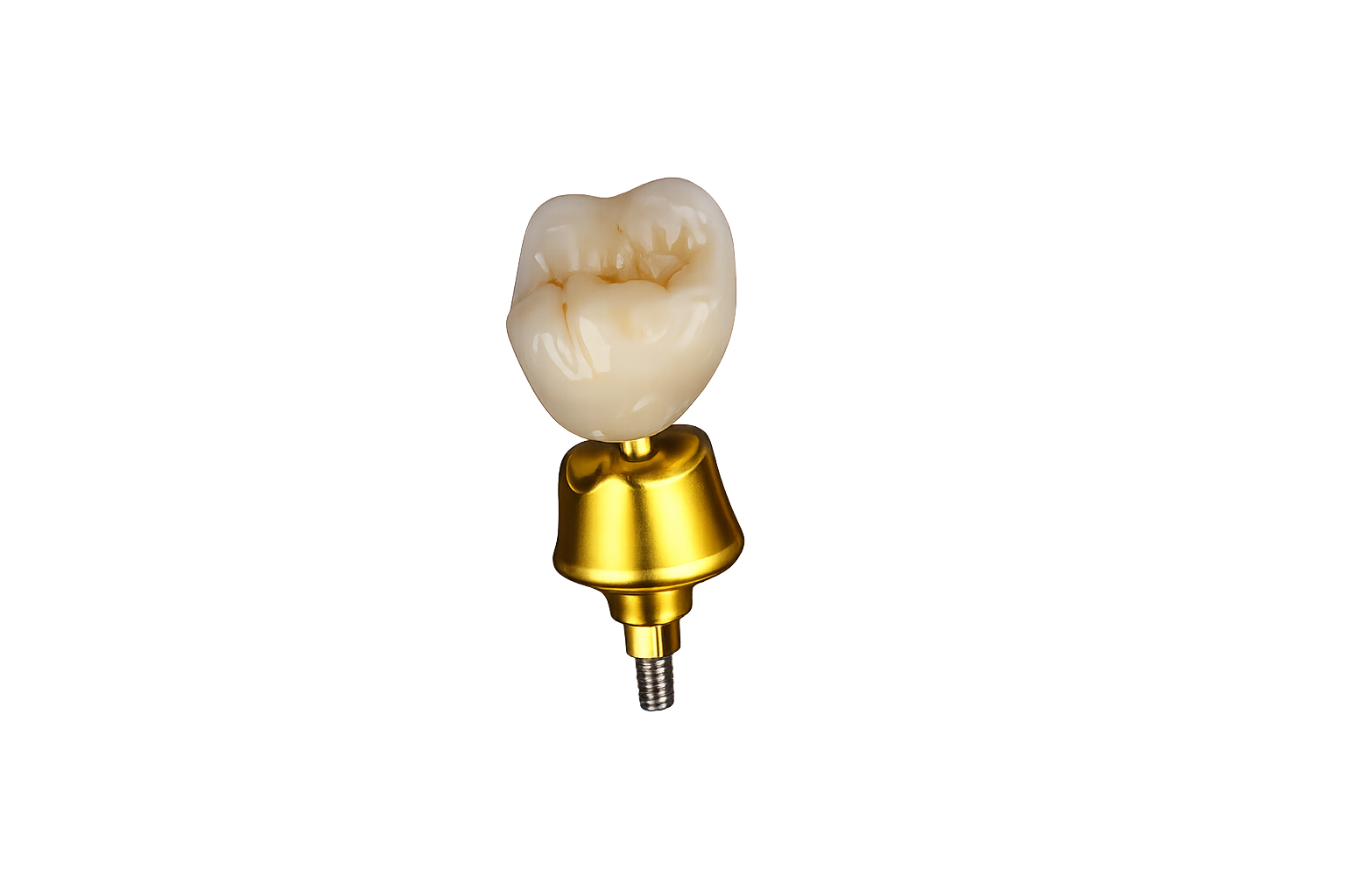 Custom Implant abutments fabricated with gold anodization by implant dental lab.