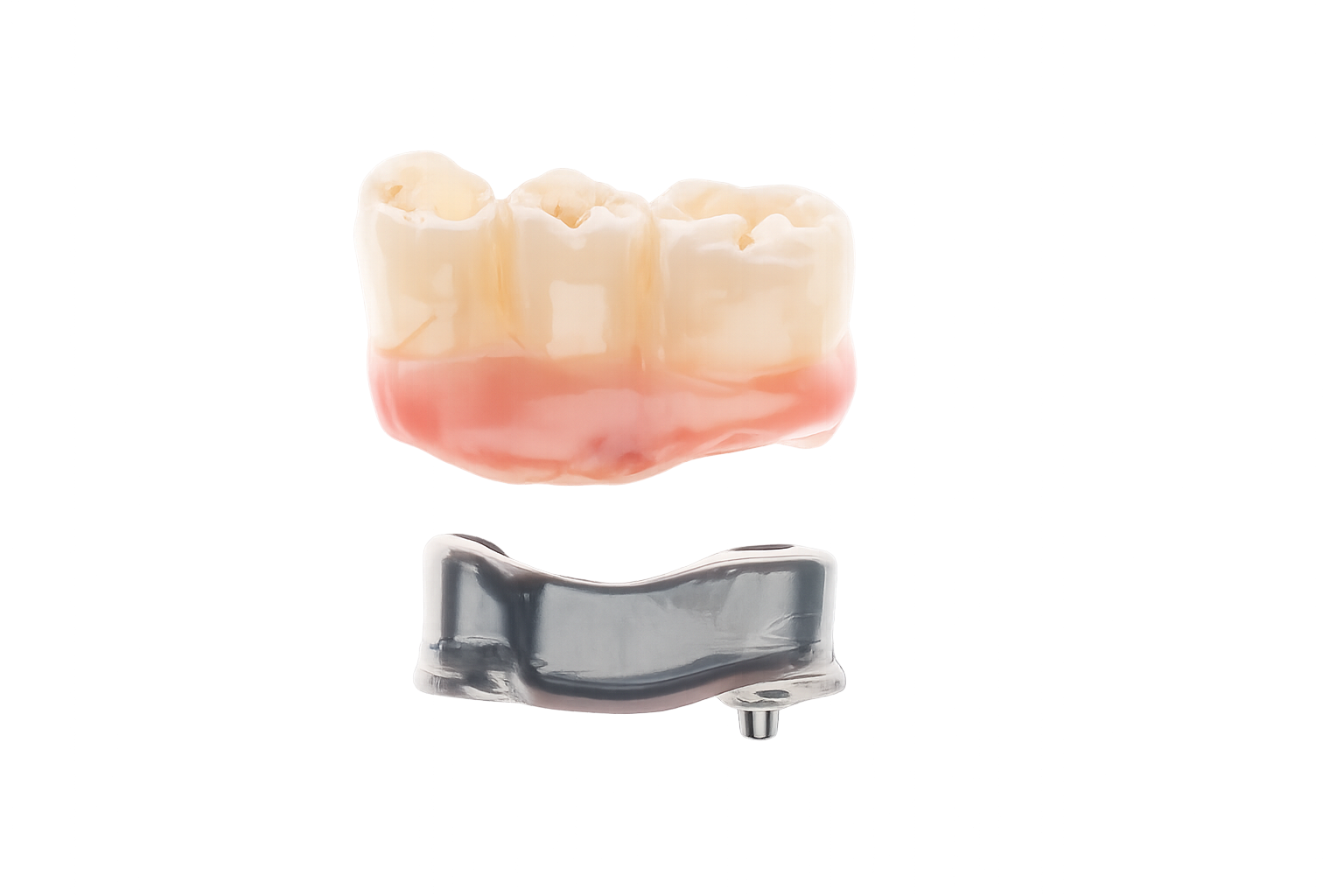 Implant Bar Solution for Implant Bridge using Blender iBar Workflow