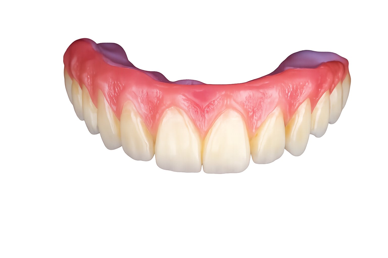 FP2 Zirconia Hybrid All-On-X Prosthesis