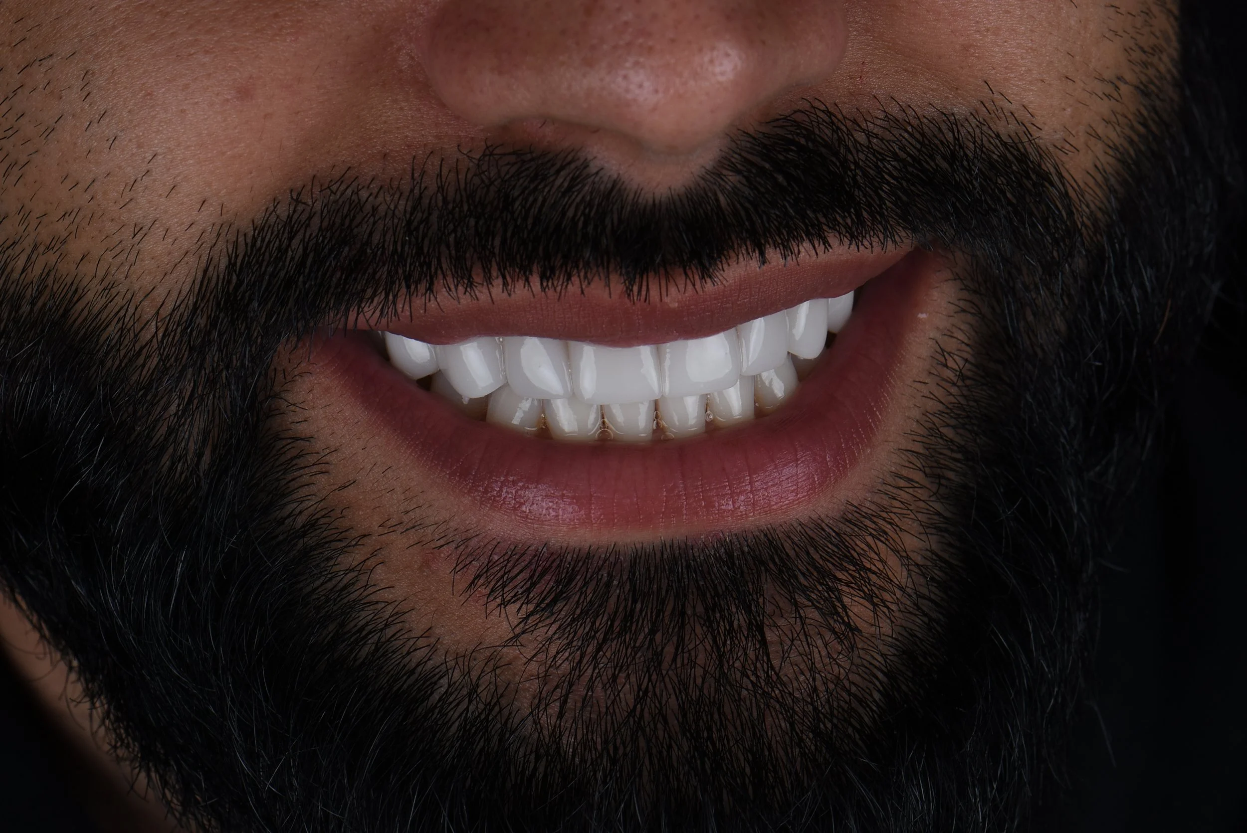 Close-up of a smiling man with dark facial hair, showing white teeth and part of his nose.