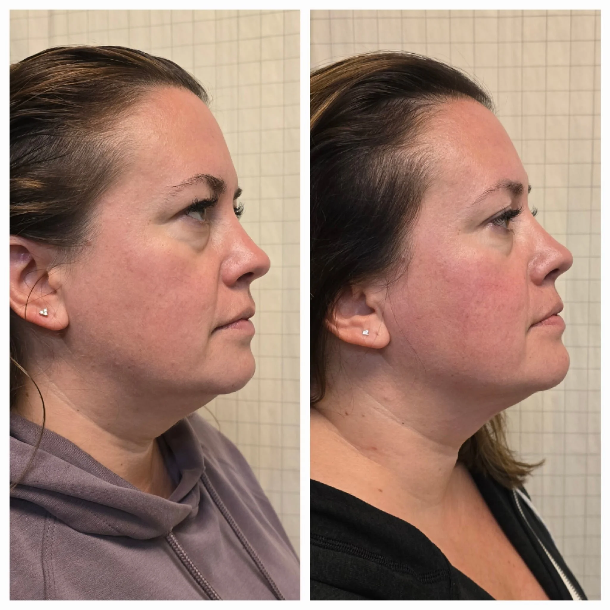 emface great results.JPG