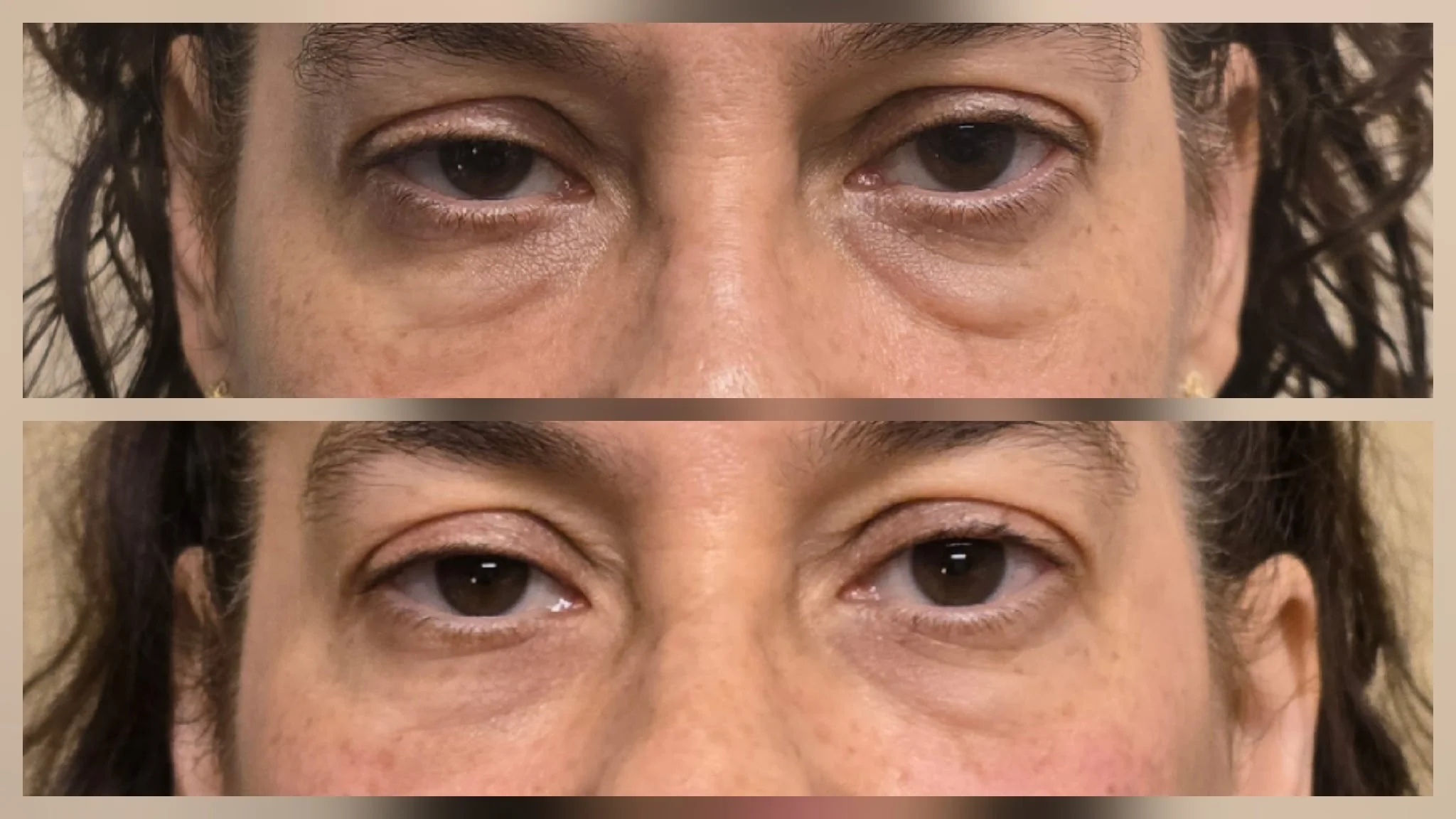 emface results.JPG