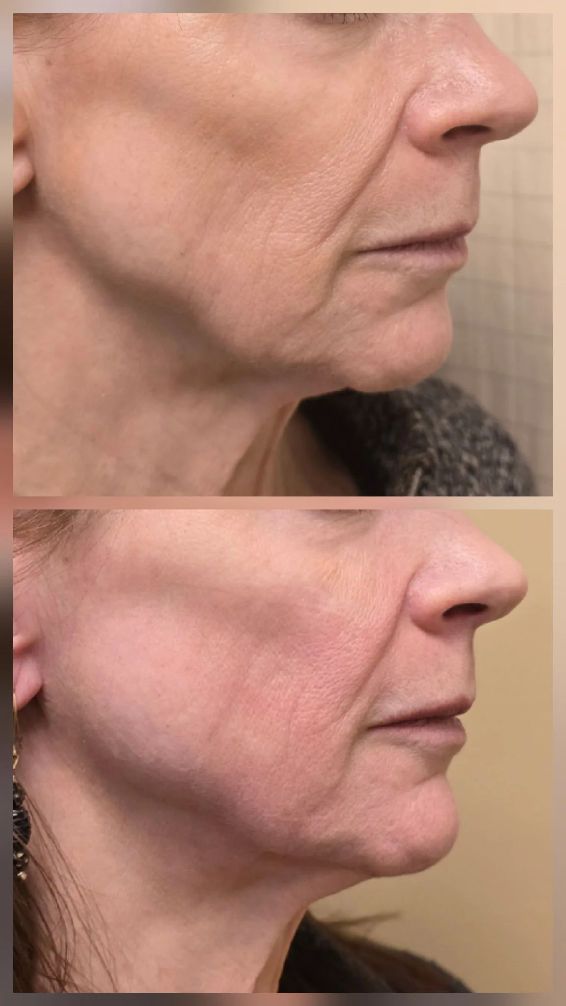 emface skincare facial.JPG