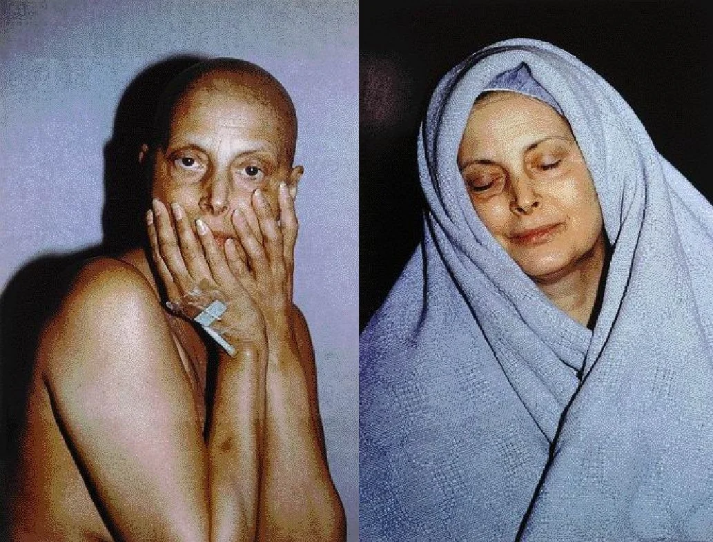 Dos retratos de una mujer, uno con la cabeza rapada y las manos en el rostro, y otro con la cabeza cubierta por una toalla azul y los ojos cerrados.