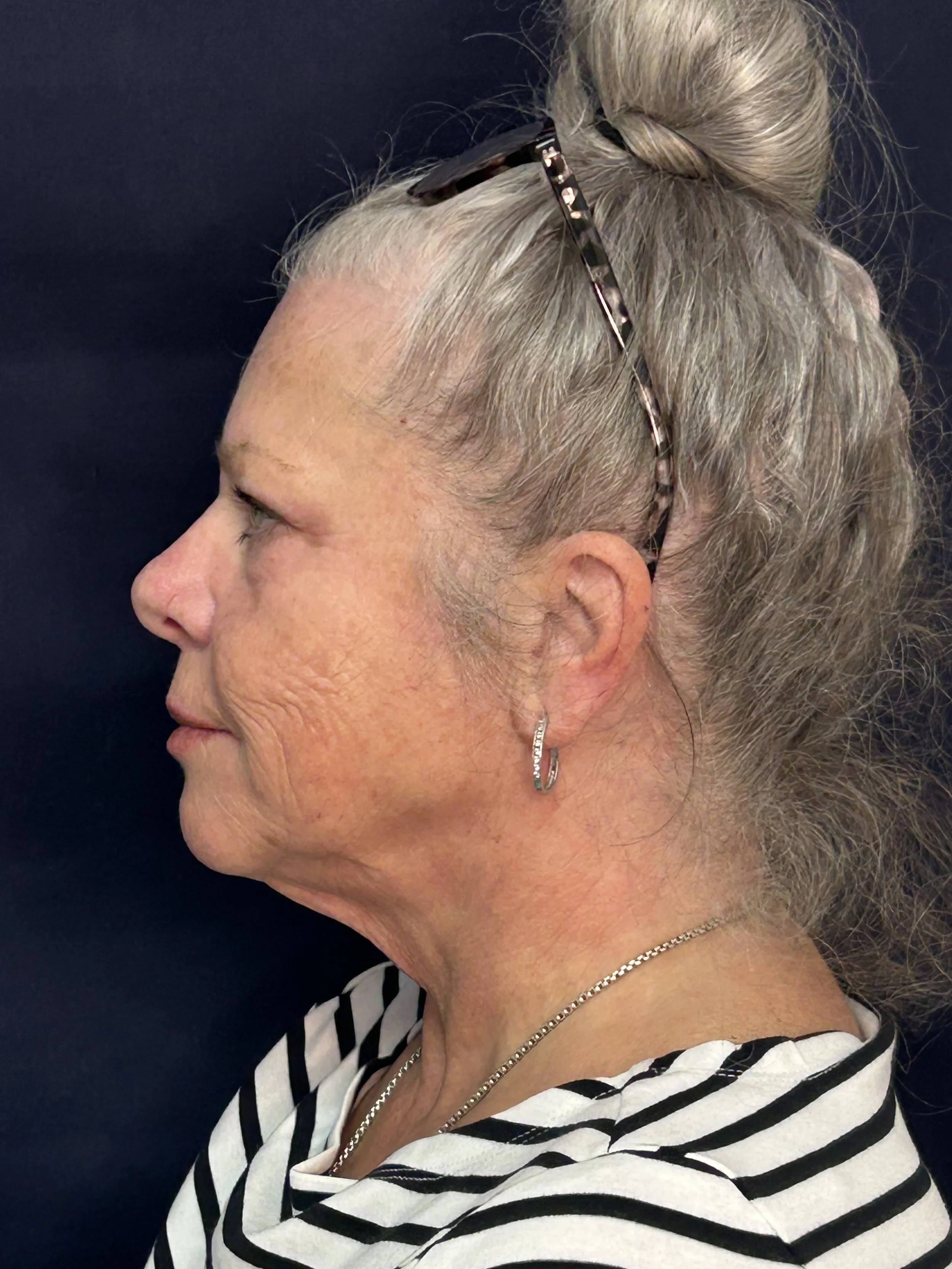 before treatment