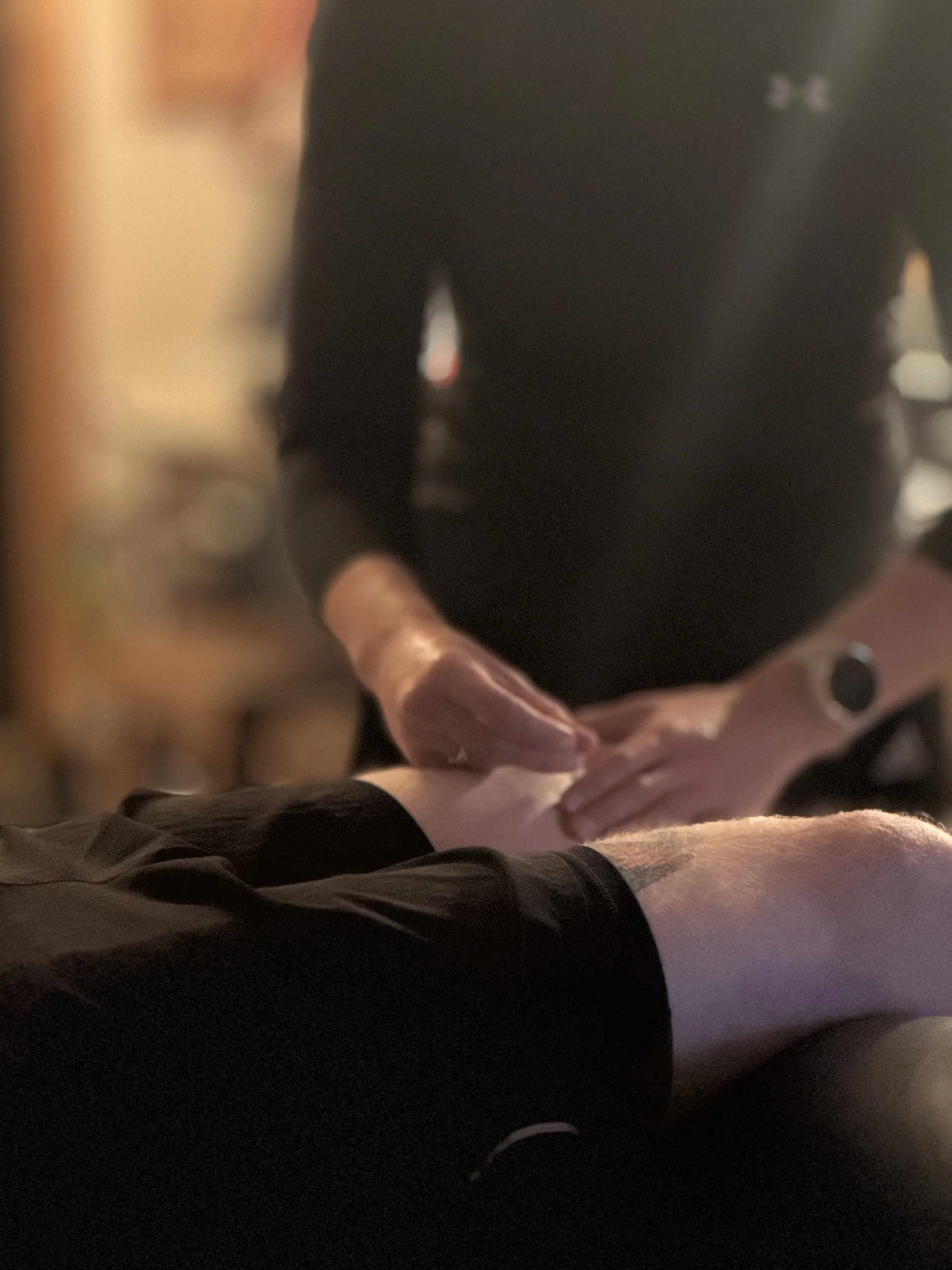A person receiving dry needling to their knee