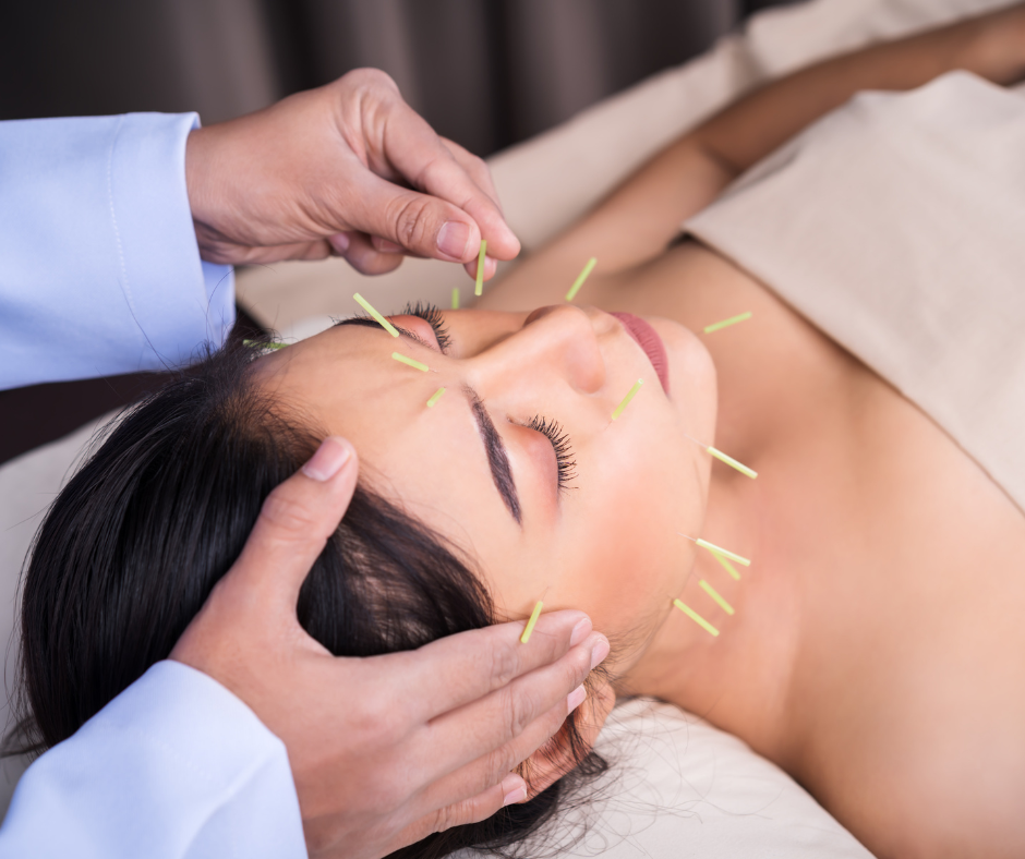 acupuncture3.png