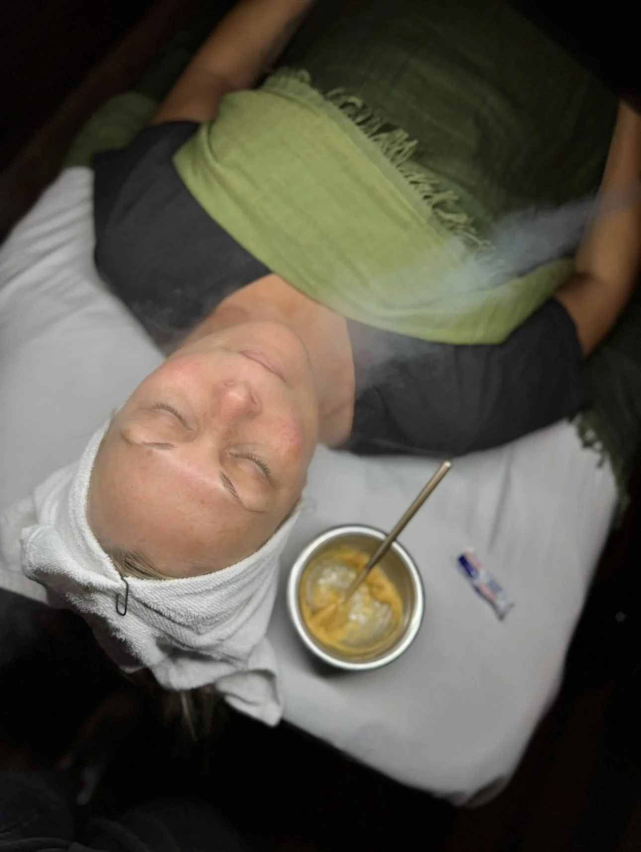 A person draped for an advanced facial including an enzyme peel and dermaplaning.