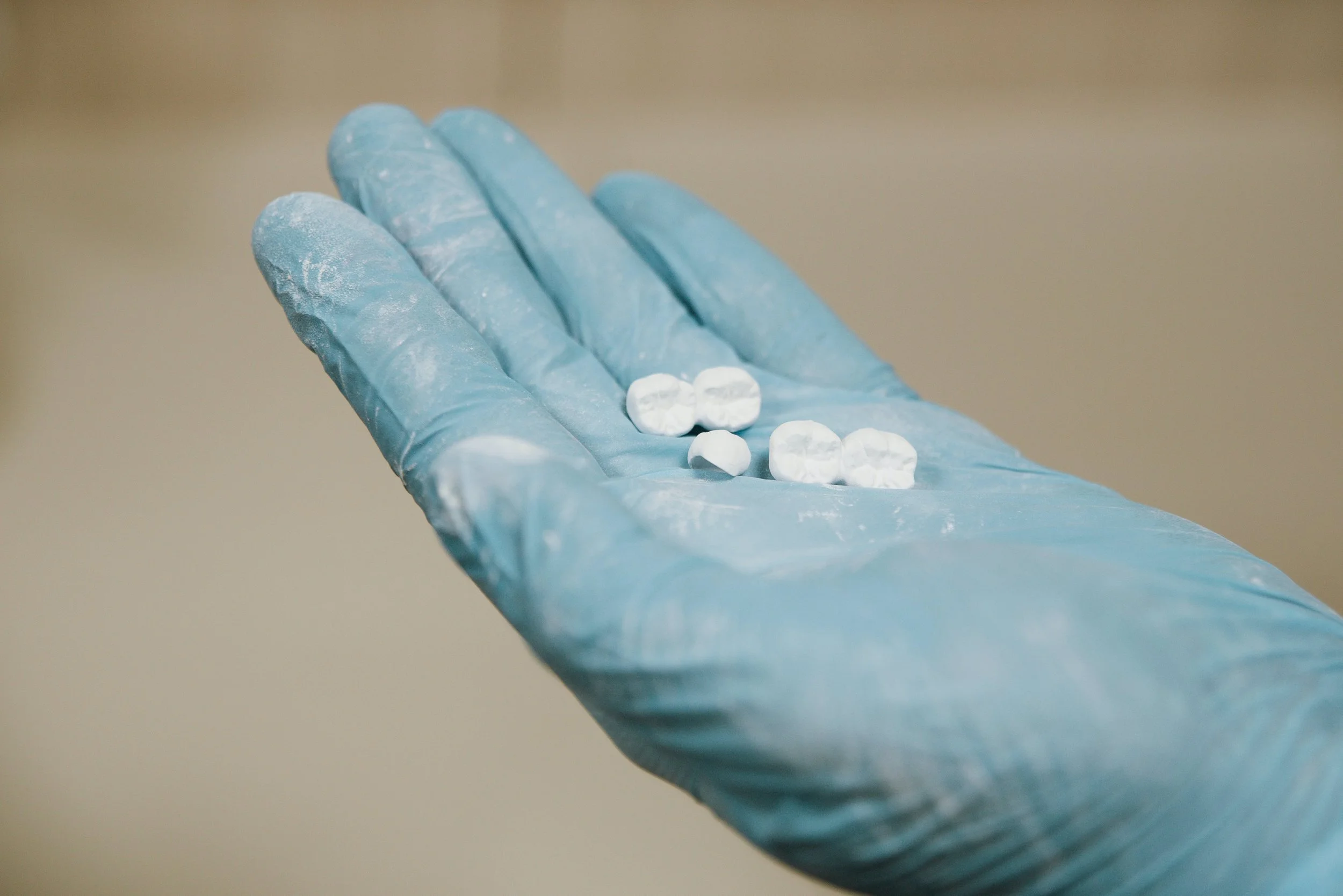 porcelain zirconia emax feldspathic