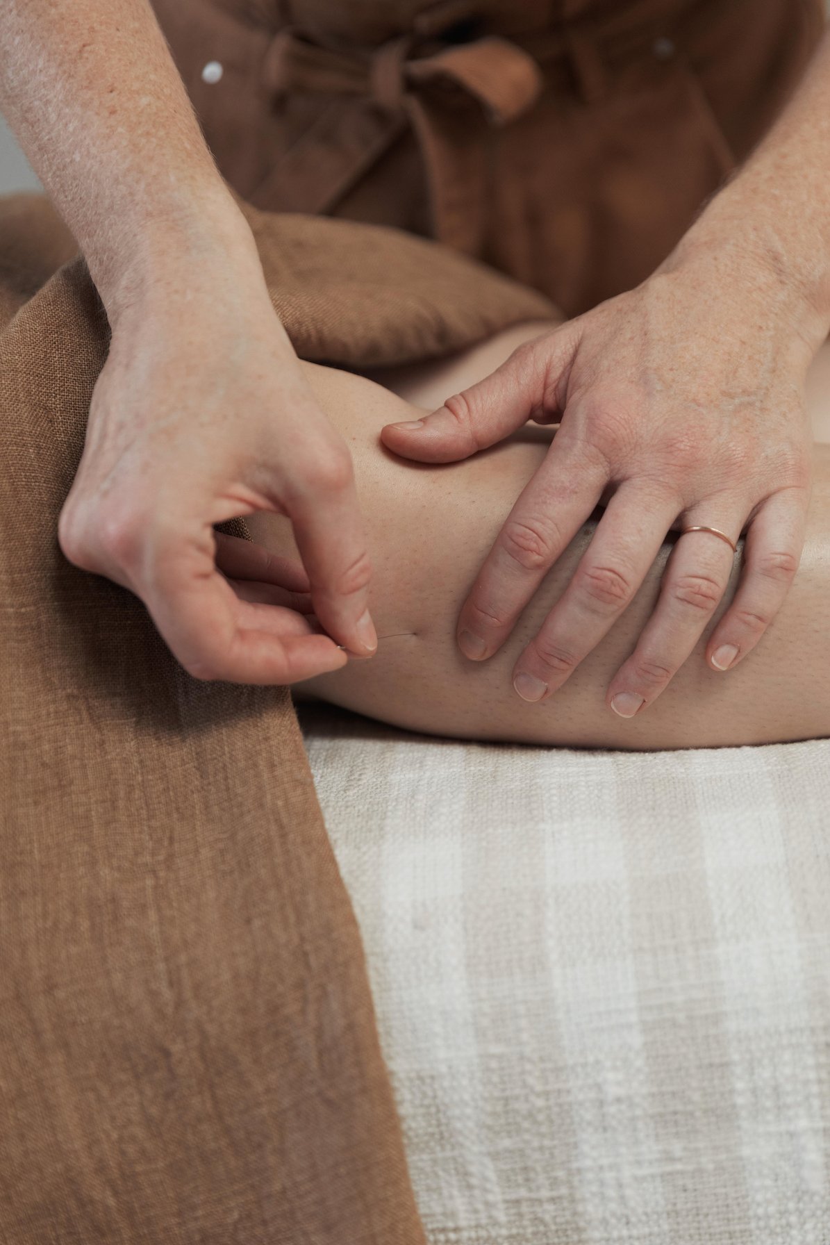 Acupuncture points for stress, anxiety and depression Albion Brisbane