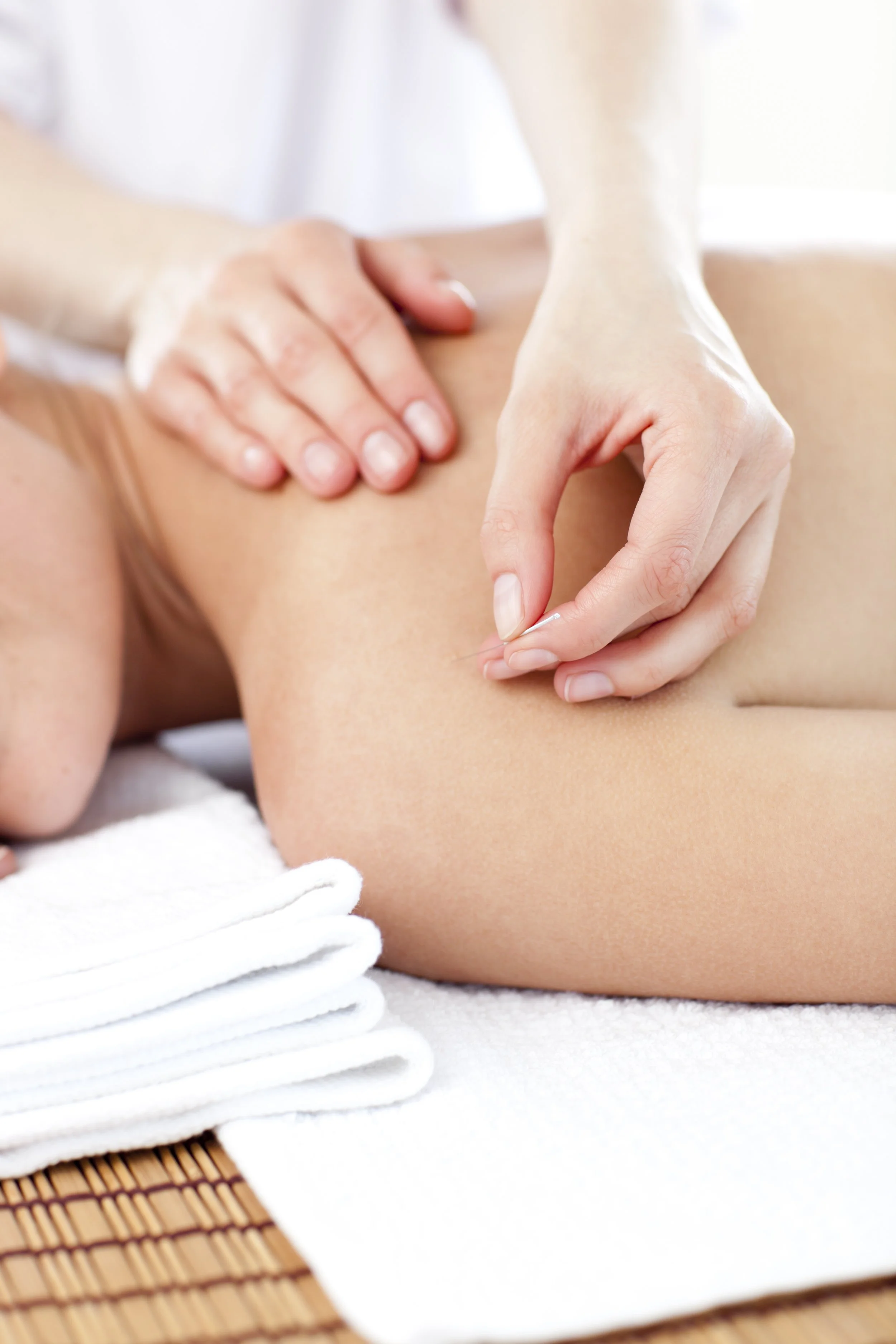 Close-up of acupunture treatment with hands placing a needle on a person's back during a wellness session.