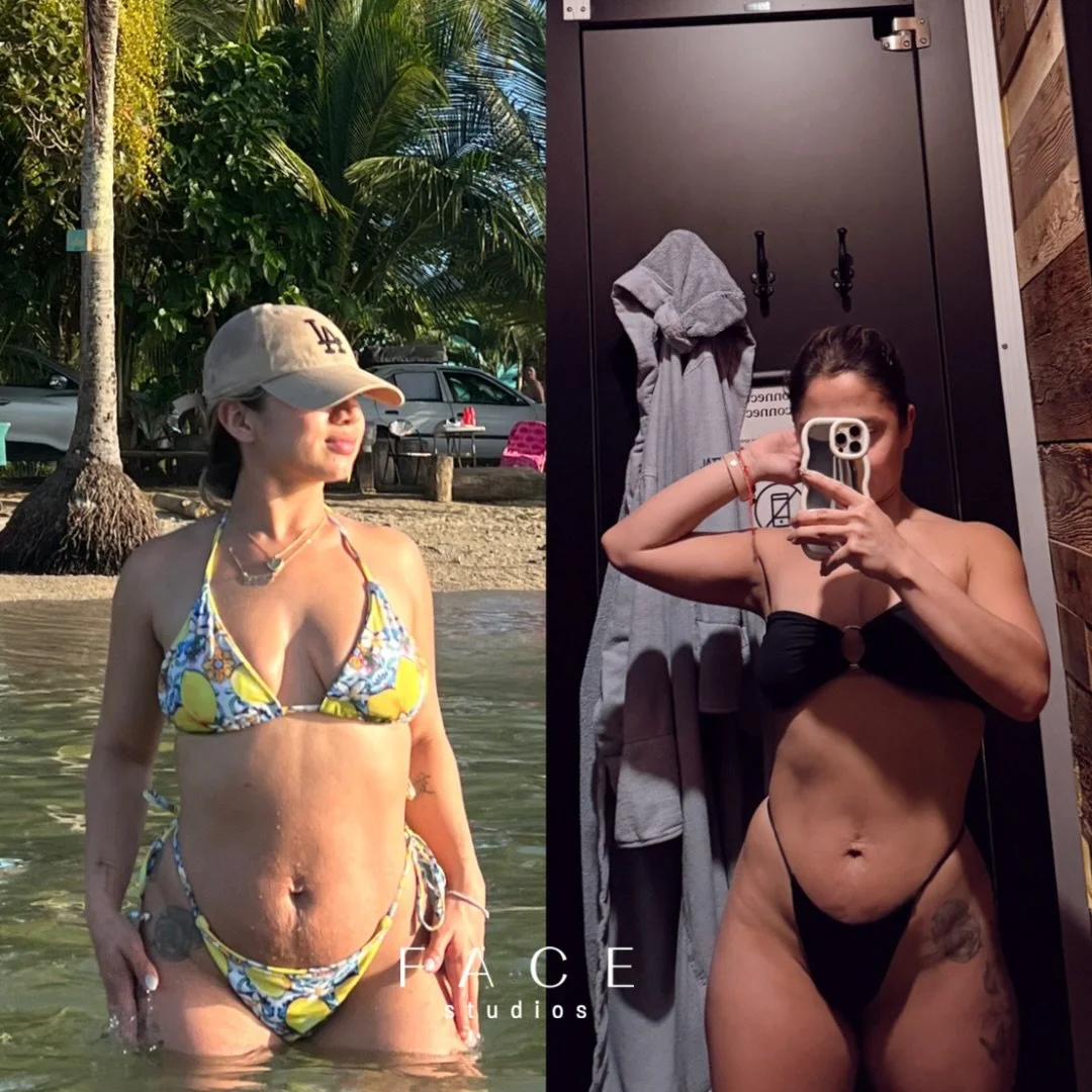 Your body did something incredible and your skin deserves care too 🤍

Postpartum microneedling supports collagen, smooths texture, and restores that glow at your own pace. This isn&rsquo;t about &ldquo;bouncing back&rdquo;, it&rsquo;s about feeling 