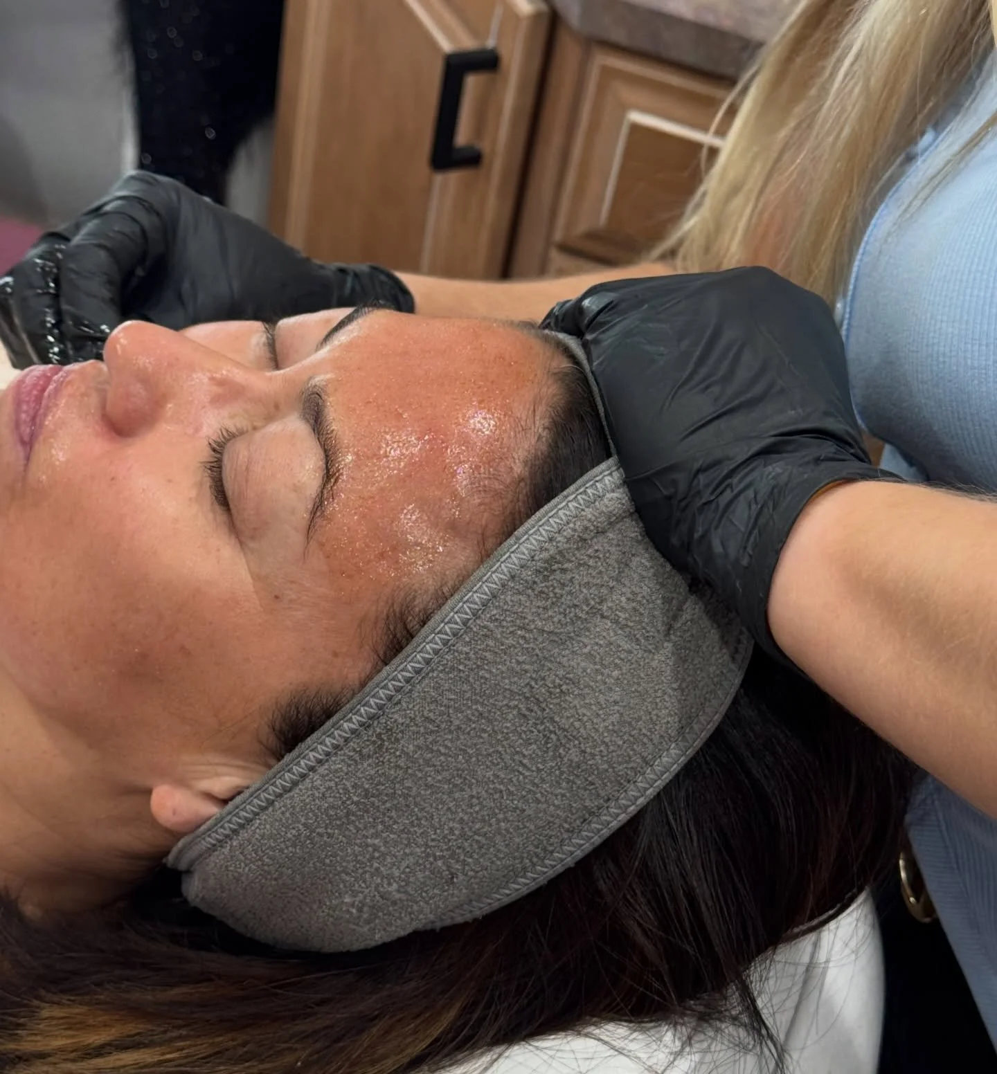 Summer is right around the corner, and there&rsquo;s no better time to reset your skin, clear out damage, and get that smooth, glowing complexion 🔥

The VI Peel targets acne, texture, pigmentation, and fine lines, aka everything you want gone before