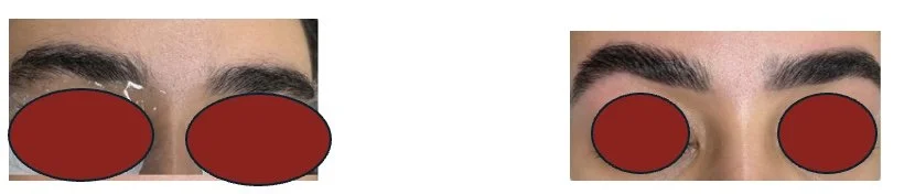 Professional Eyebrow Shaping