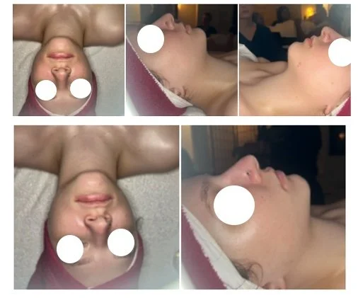 Facial