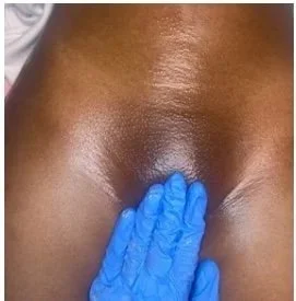 Complete Brazilian Wax and Vajacial