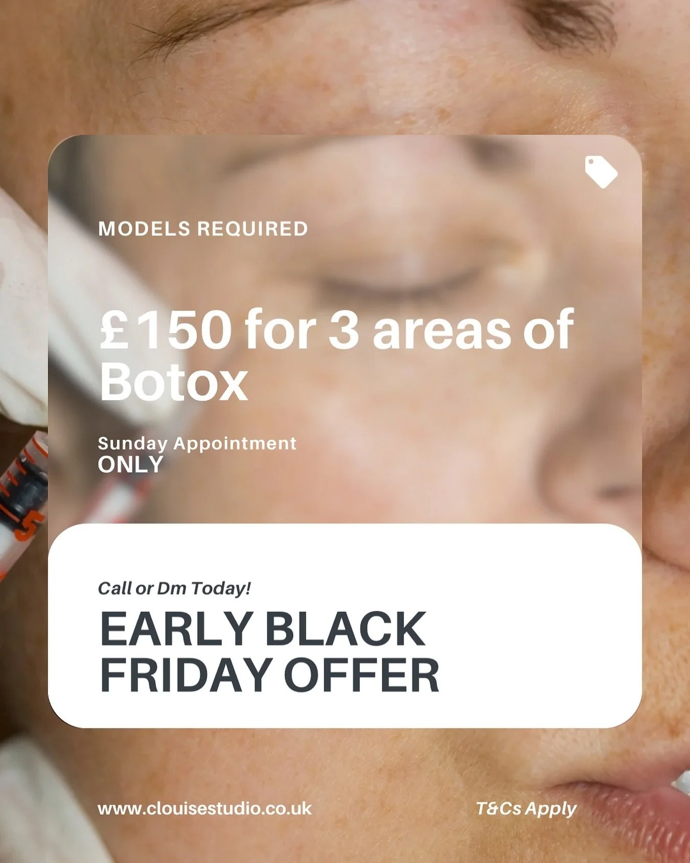 As part of our model program, we&rsquo;re offering an exclusive early Black Friday deal: &pound;150 for 3 areas of Botox.

This is your chance to enjoy professional aesthetic treatments in a private, welcoming setting. Appointments are available Sund