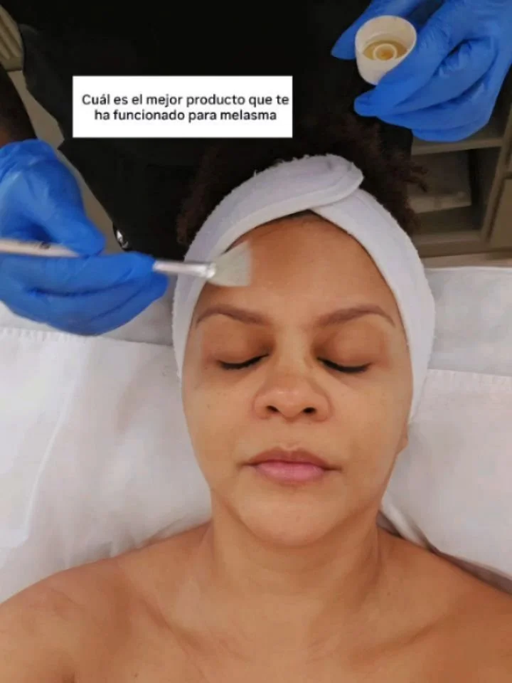 Uno de los productos m&aacute;s efectivos para mis manchas 🙌 Ayer en YouTube les di mis mejores recomendaciones de exfoliantes y peelings para hacer en casa, pero esos para m&iacute; son un complemento a los peelings qu&iacute;micos que me estoy hac