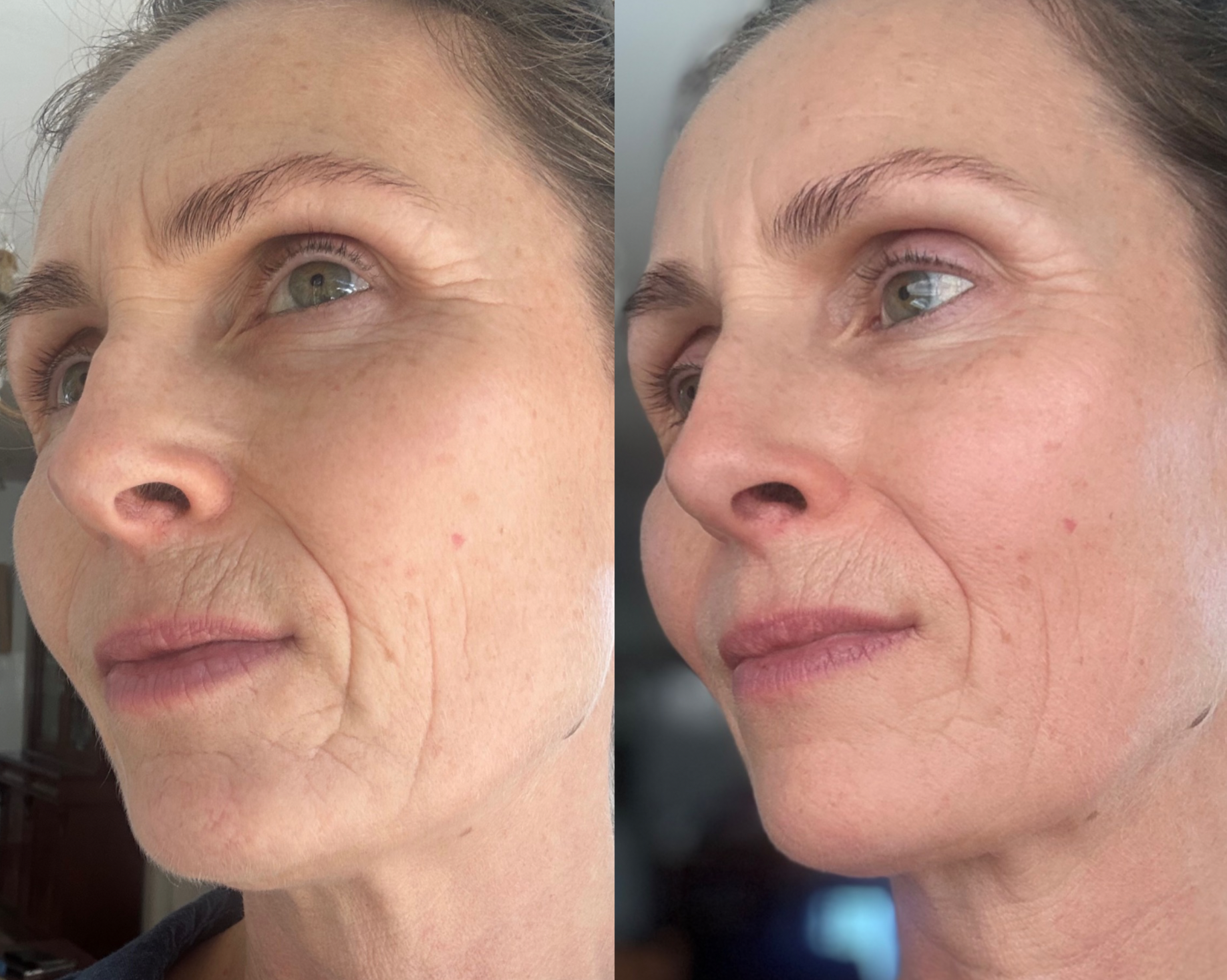 Spotlight: Gua Sha Self Care on the Lower Face