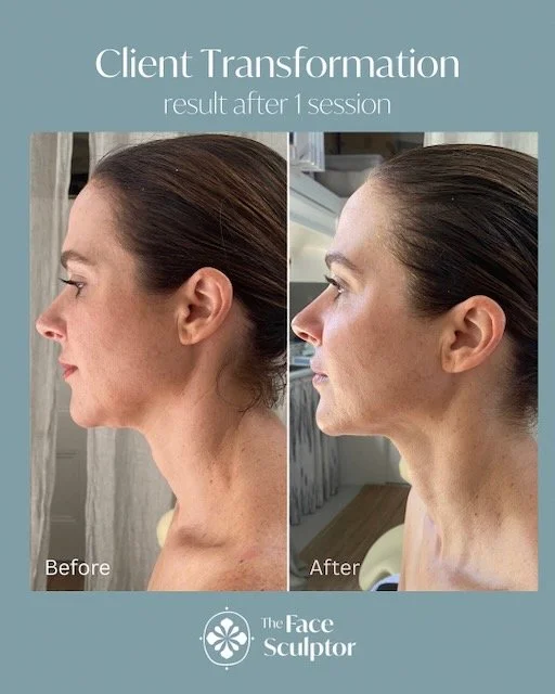 Before & After: Result after 1 session