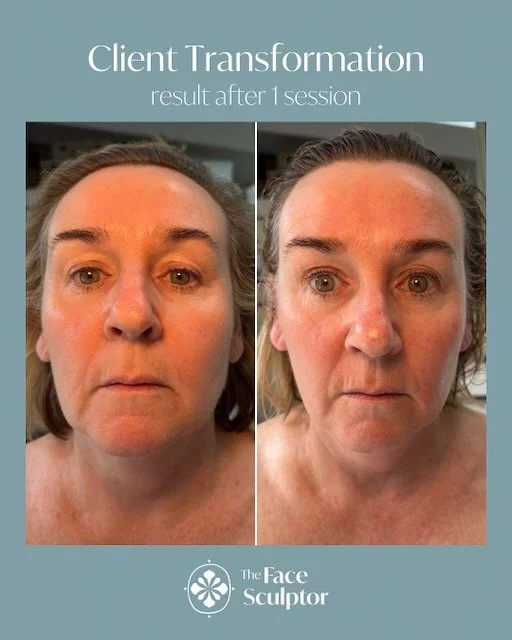 Before & After: Result after 1 session